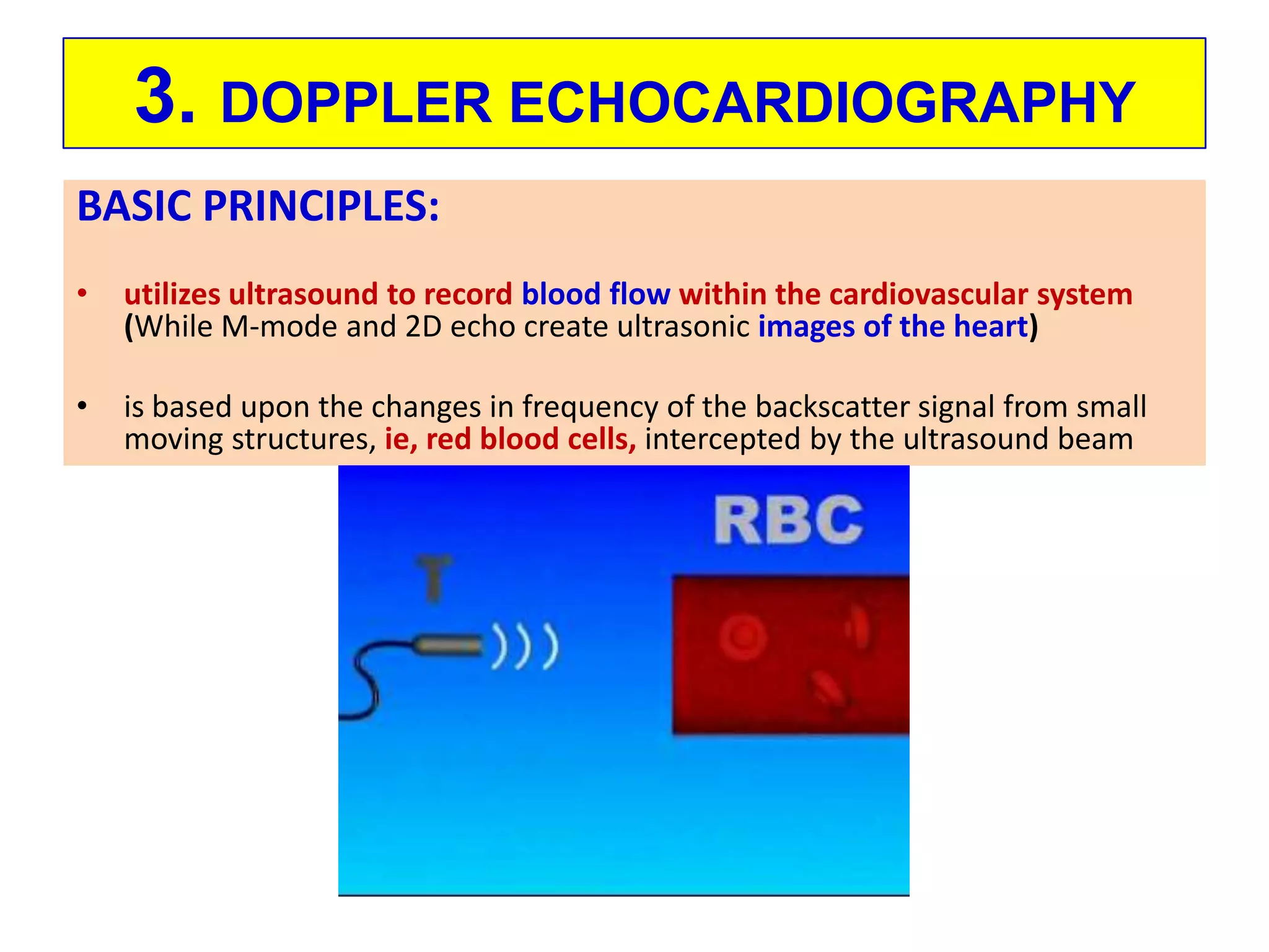 B.  M-MODE ECHOCARDIOGRAPHYa single line of sight is included, the repetition frequency of the pulse transmission is very high and sampling rates of around 1800 cycles/sec are usedContinuously-moving structures may be identified more accurately when motion versus time, as well as depth, is displayed clearly on the M-mode recording