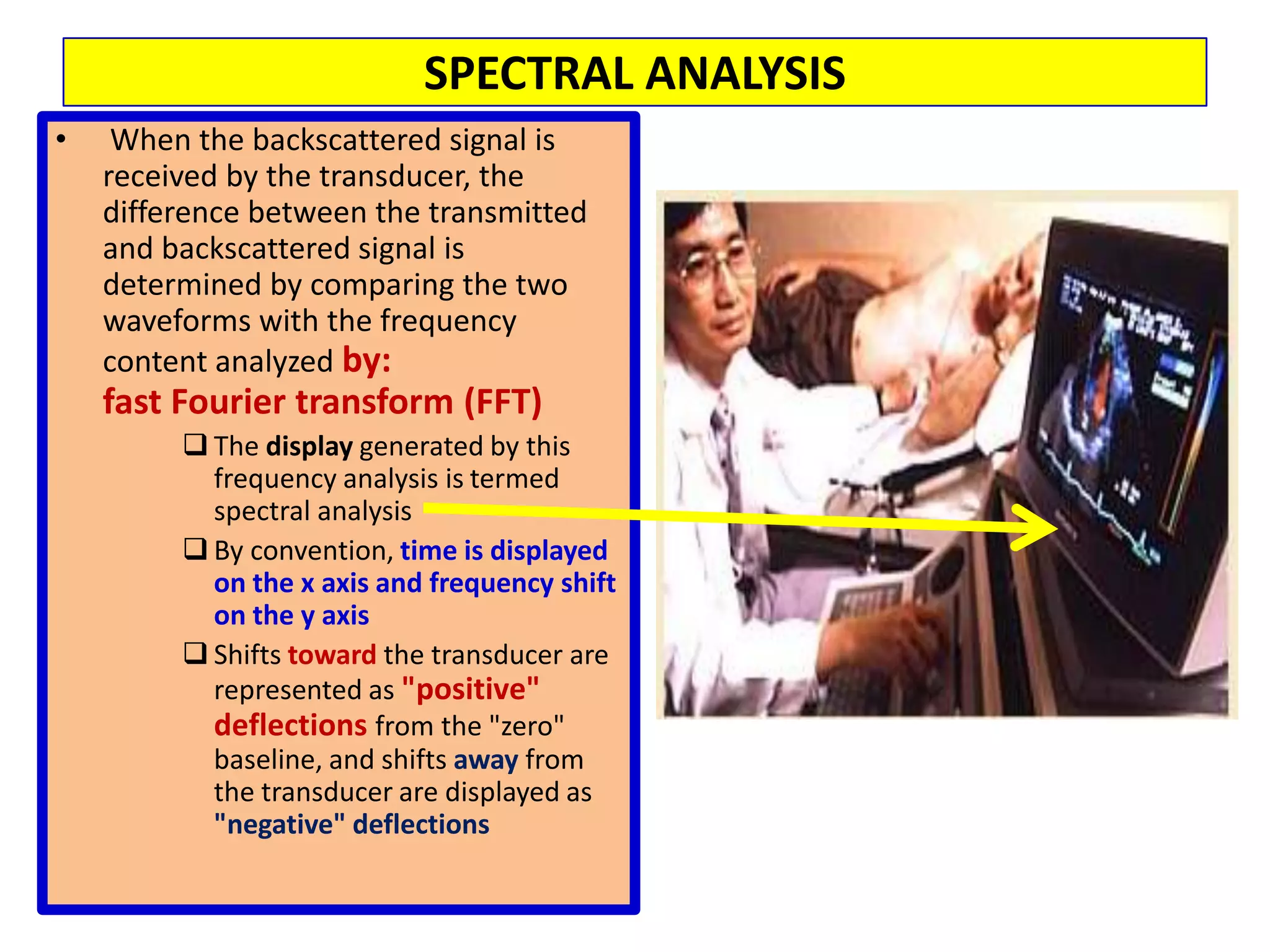 M-mode recording perpendicular to the long axis of and through the centre of the left ventricle at papillary muscle level provides standard measurements of systolic and diastolic thickness and chamber dimensions:
