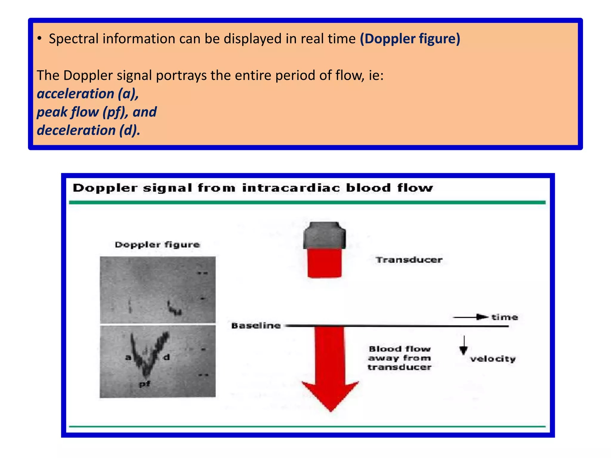 Normal ValuesLeft ventricular end-diastole:  37 - 57 mm (23 -31 mm/m²)Left ventricular end-systole:  21 - 40 mm (14 -21 mm/m²)Interventricular septum:  7 - 11 mmPosterior wall:  7 - 11 mm