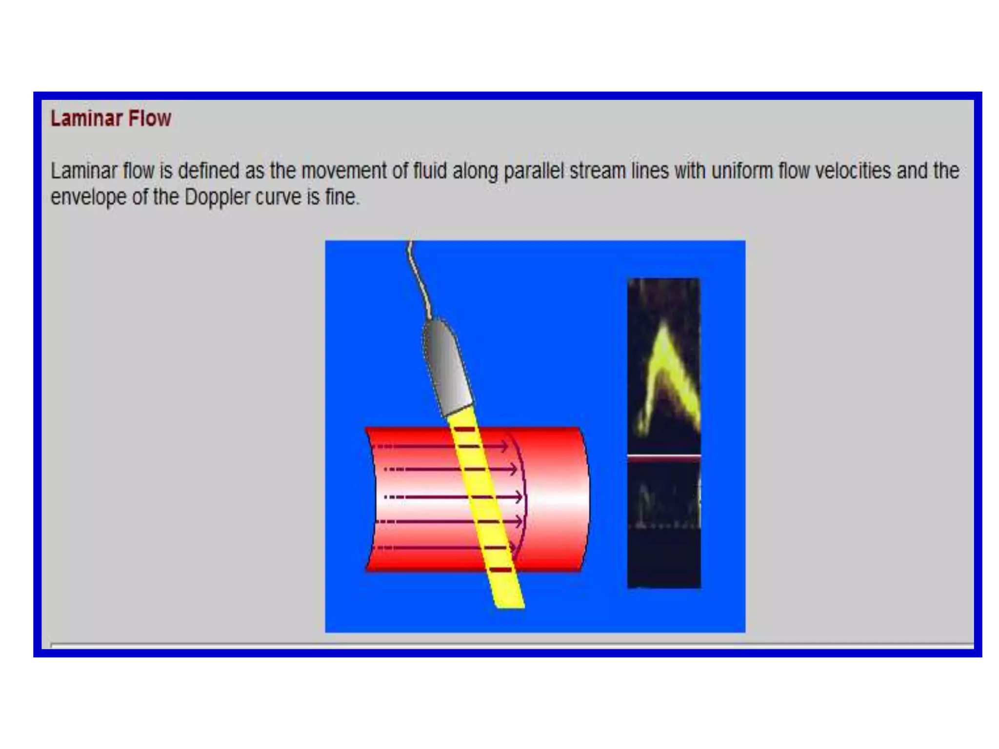 A moving target will backscatter an ultrasound beam to the transducer so that the frequency observed when the target is moving toward the transducer is higher and the frequency observed when the target is moving away from the transducer is lower than the original transmitter frequencyThis Doppler phenomenon is familiar to us as the sound of a train whistle as it moves toward (higher frequency) or away (lower frequency) from the observer