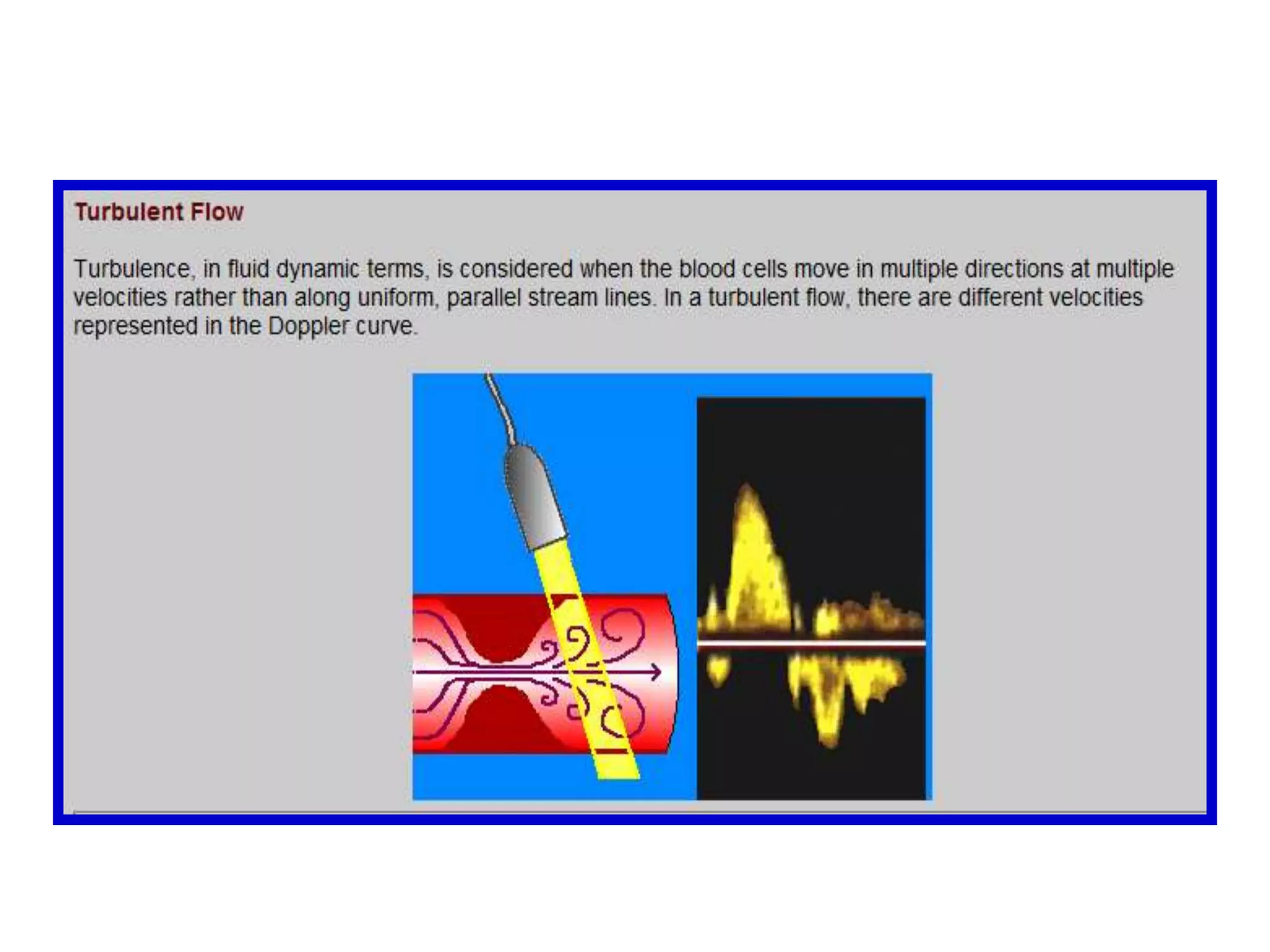 This difference in frequency between the transmitted frequency (F[t]) and received frequency (F[r]) is the Doppler shift: