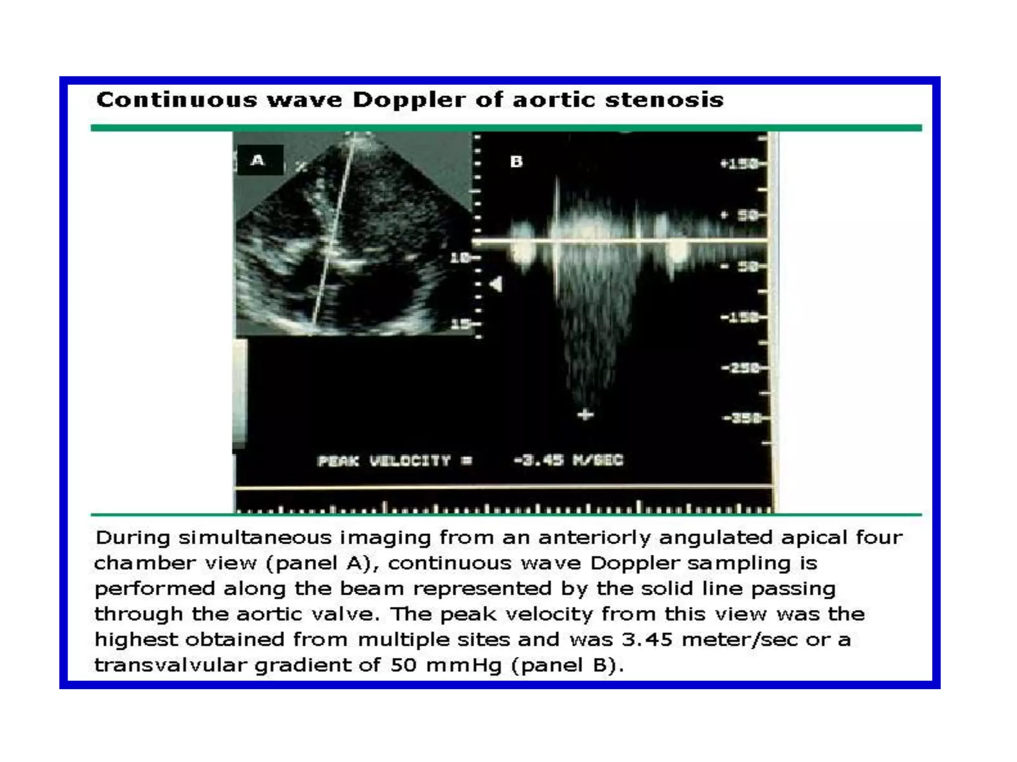 By convention, time is displayed on the x axis and frequency shift on the y axis