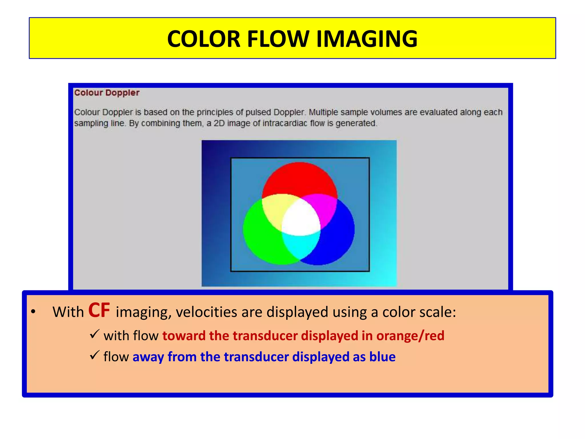 Right Ventricular InflowCan be recorded from an apical approach. The pattern is similar to mitral flow.