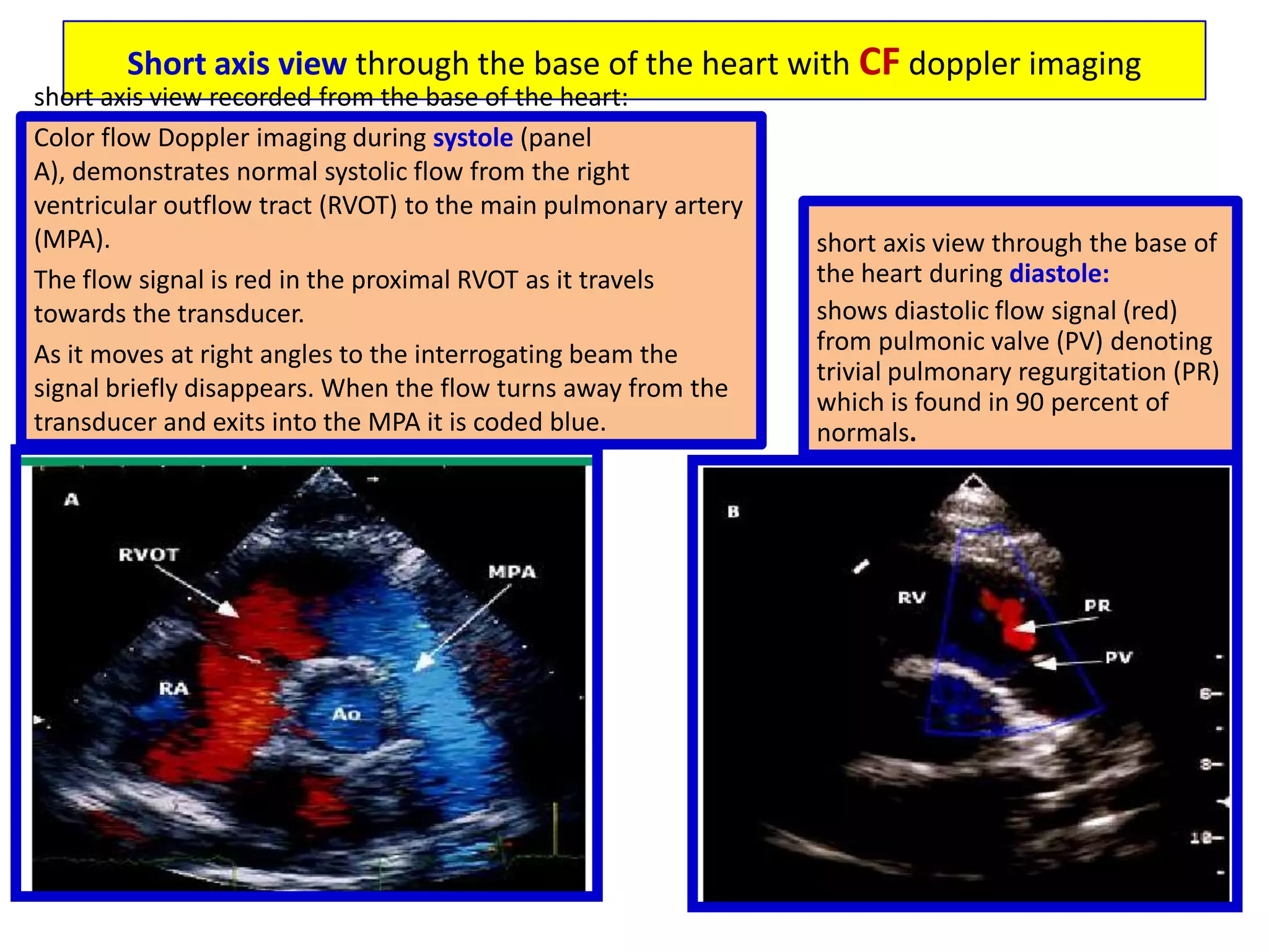 Thus, there may be overlap in certain settings, such as: