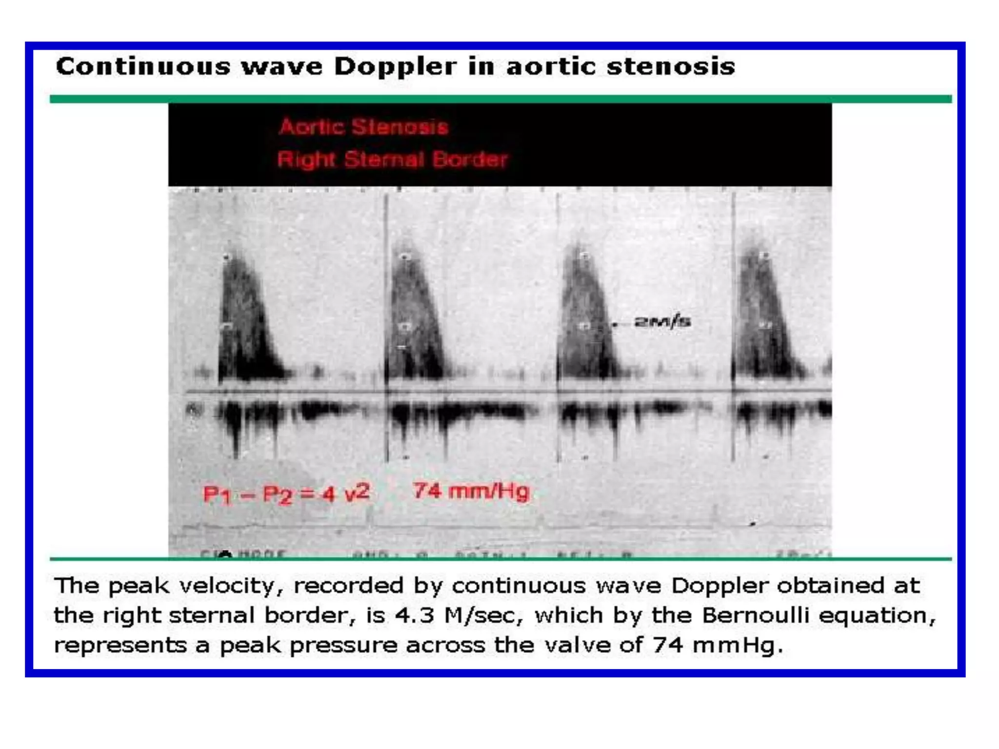 with flow toward the transducer displayed in orange/red 