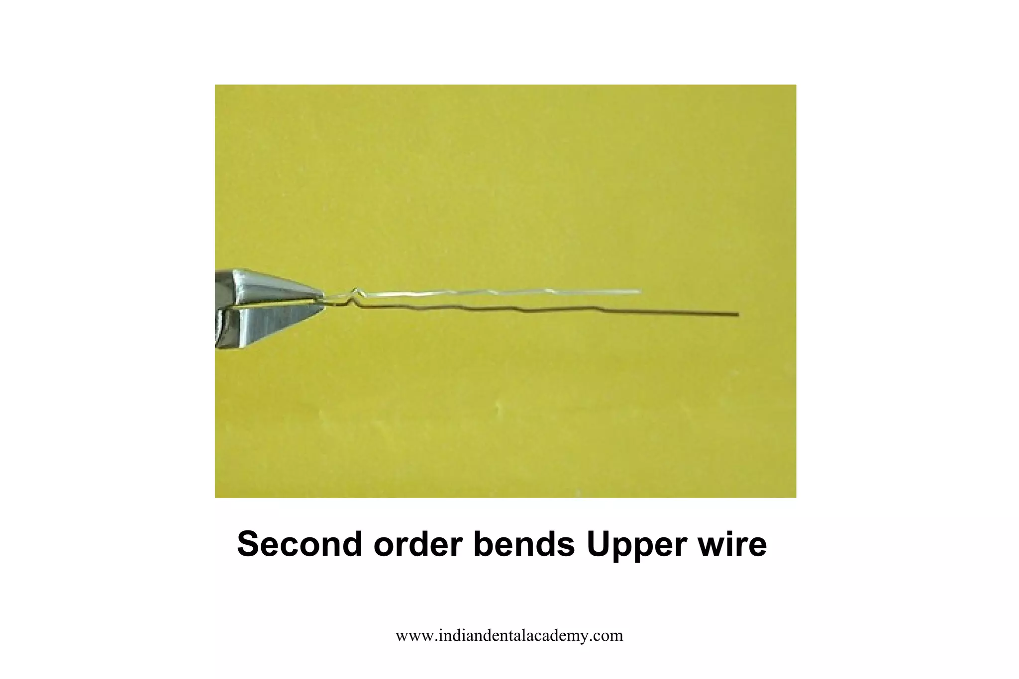 Second order bends Upper wire
www.indiandentalacademy.com

 