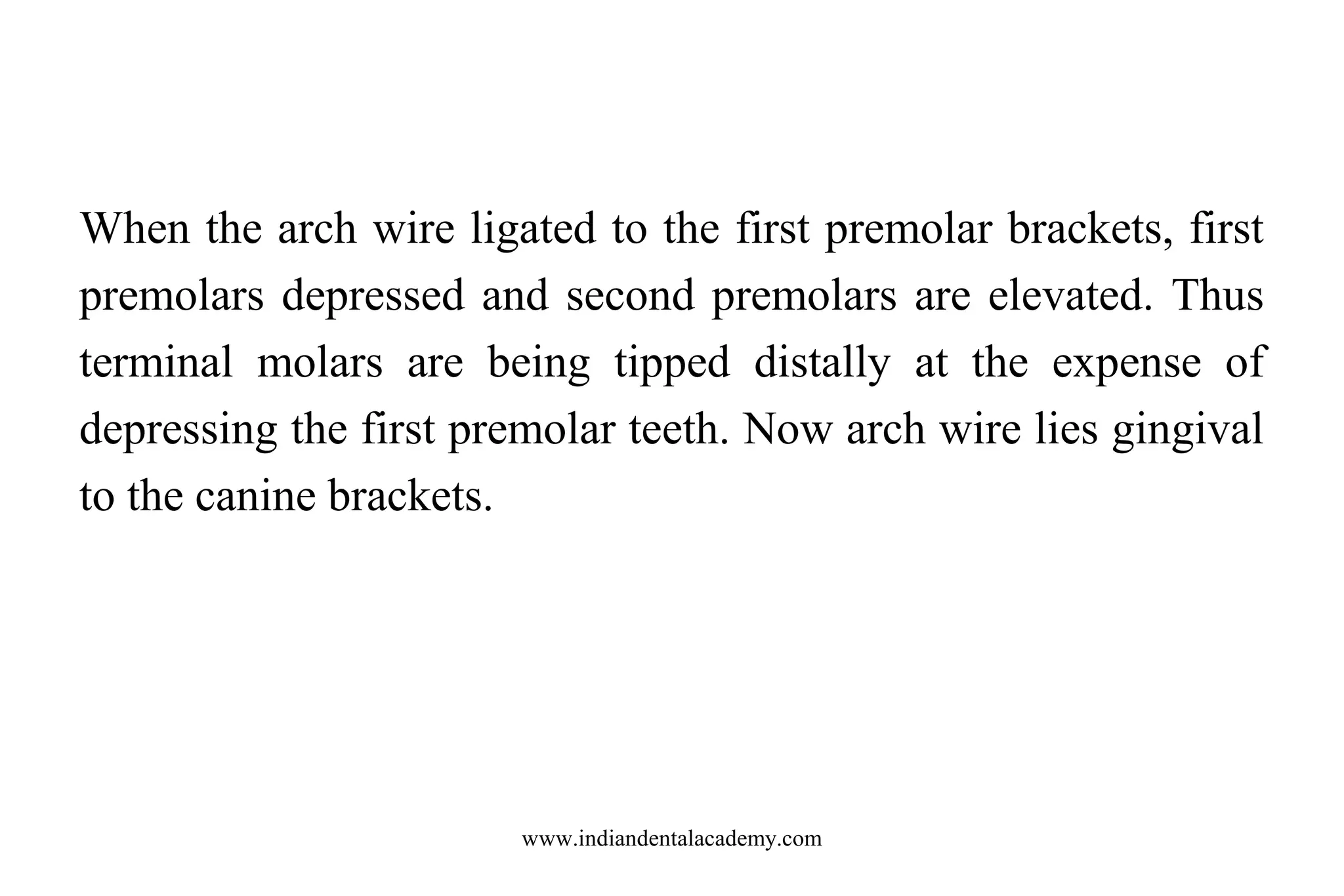 When the arch wire ligated to the first premolar brackets, first
premolars depressed and second premolars are elevated. Thus
terminal molars are being tipped distally at the expense of
depressing the first premolar teeth. Now arch wire lies gingival
to the canine brackets.

www.indiandentalacademy.com

 