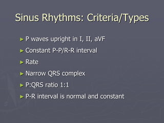Basics of EKG Interpretation.ppt