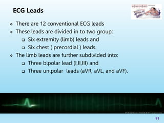  There are 12 conventional ECG leads
 These leads are divided in to two group;
 Six extremity (limb) leads and
 Six chest ( precordial ) leads.
 The limb leads are further subdivided into:
 Three bipolar lead (I,II,III) and
 Three unipolar leads (aVR, aVL, and aVF).
11
ECG Leads
 