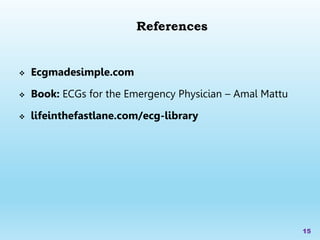  Ecgmadesimple.com
 Book: ECGs for the Emergency Physician – Amal Mattu
 lifeinthefastlane.com/ecg-library
15
References
 