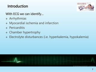 With ECG we can identify…
 Arrhythmias
 Myocardial ischemia and infarction
 Pericarditis
 Chamber hypertrophy
 Electrolyte disturbances (i.e. hyperkalemia, hypokalemia)
7
Introduction
 