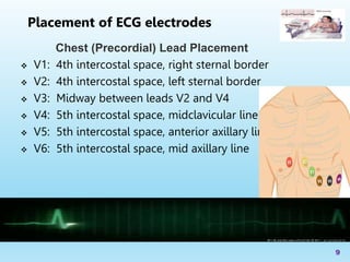 Chest (Precordial) Lead Placement
 V1: 4th intercostal space, right sternal border
 V2: 4th intercostal space, left sternal border
 V3: Midway between leads V2 and V4
 V4: 5th intercostal space, midclavicular line
 V5: 5th intercostal space, anterior axillary line
 V6: 5th intercostal space, mid axillary line
9
Placement of ECG electrodes
 