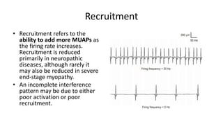Basics of emg | PPT