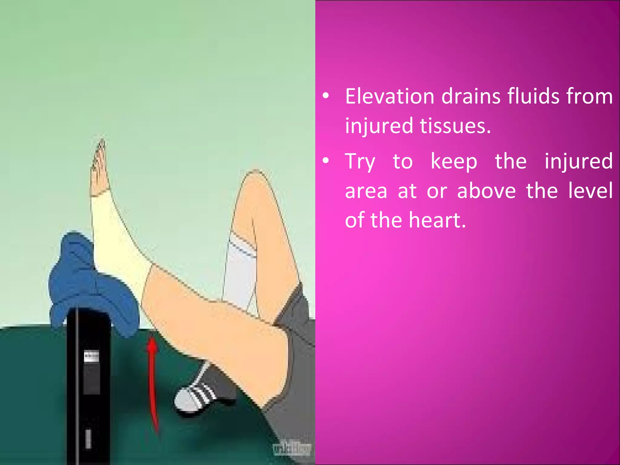 • Elevation drains fluids from 
injured tissues. 
• Try to keep the injured 
area at or above the level 
of the heart. 
 