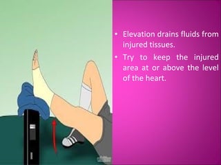 • Elevation drains fluids from 
injured tissues. 
• Try to keep the injured 
area at or above the level 
of the heart. 
 