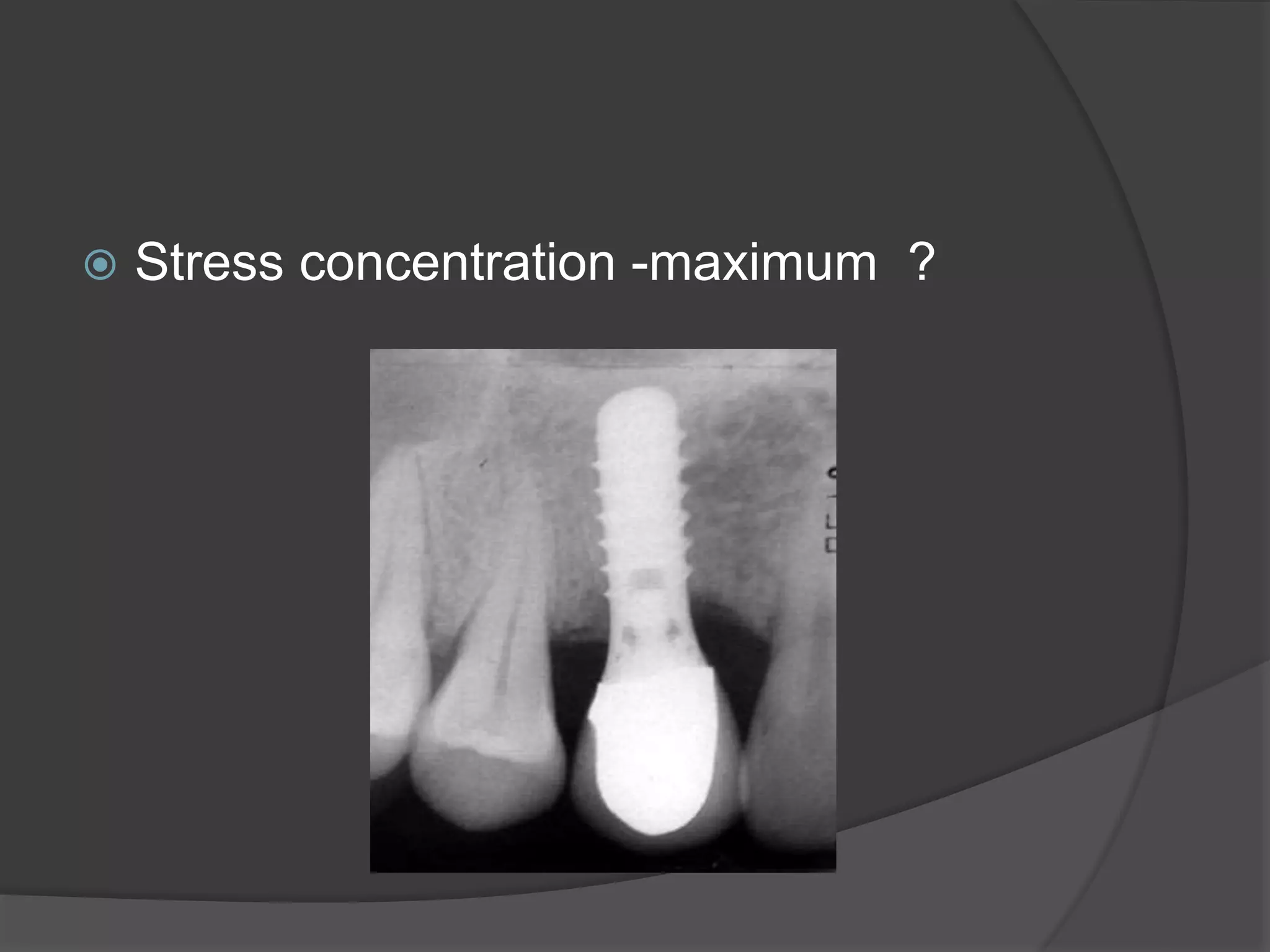  Stress concentration -maximum ?
 
