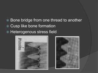 basics of implantology.ppt
