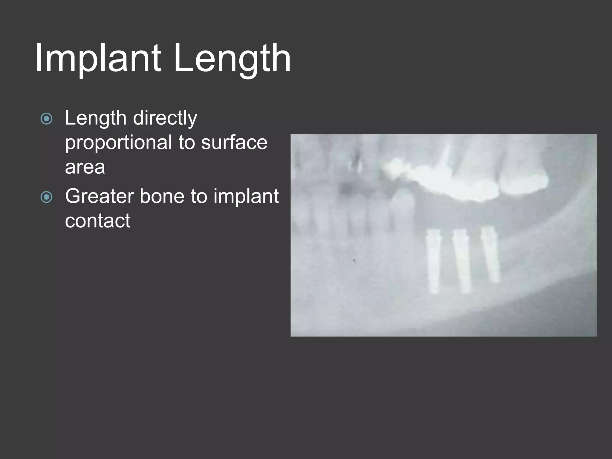 Implant Length
 Length directly
proportional to surface
area
 Greater bone to implant
contact
 