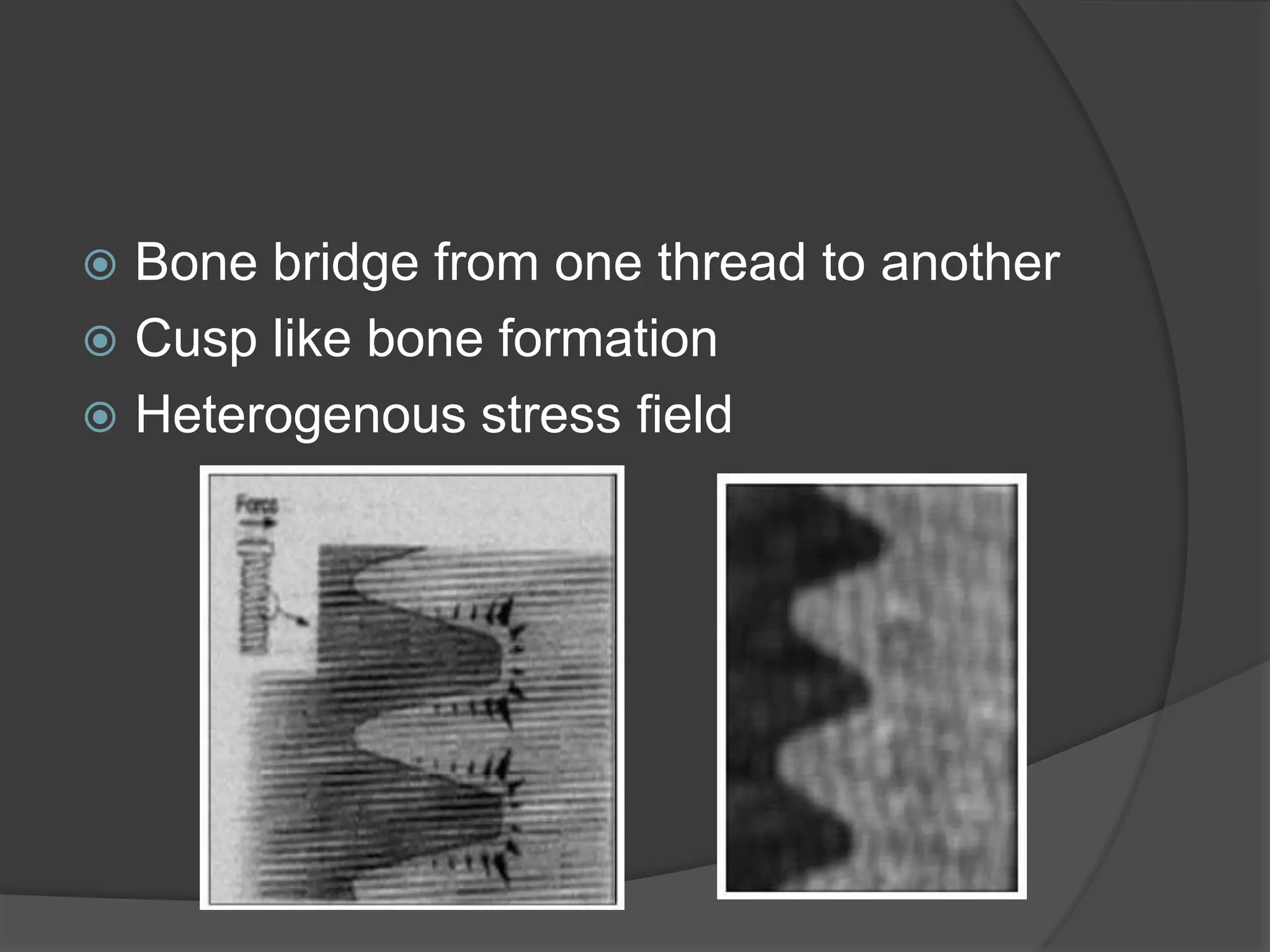  Bone bridge from one thread to another
 Cusp like bone formation
 Heterogenous stress field
 
