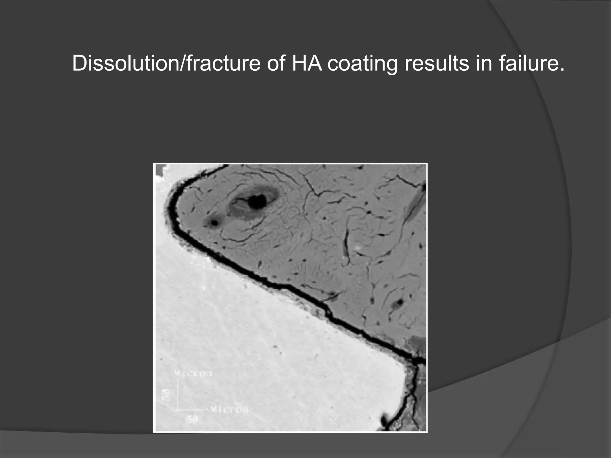 Dissolution/fracture of HA coating results in failure.
 