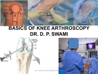 BASICS OF KNEE ARTHROSCOPY
DR. D. P. SWAMI
DPS " ONLY FOR EDUCATIONAL PURPOSES"
 