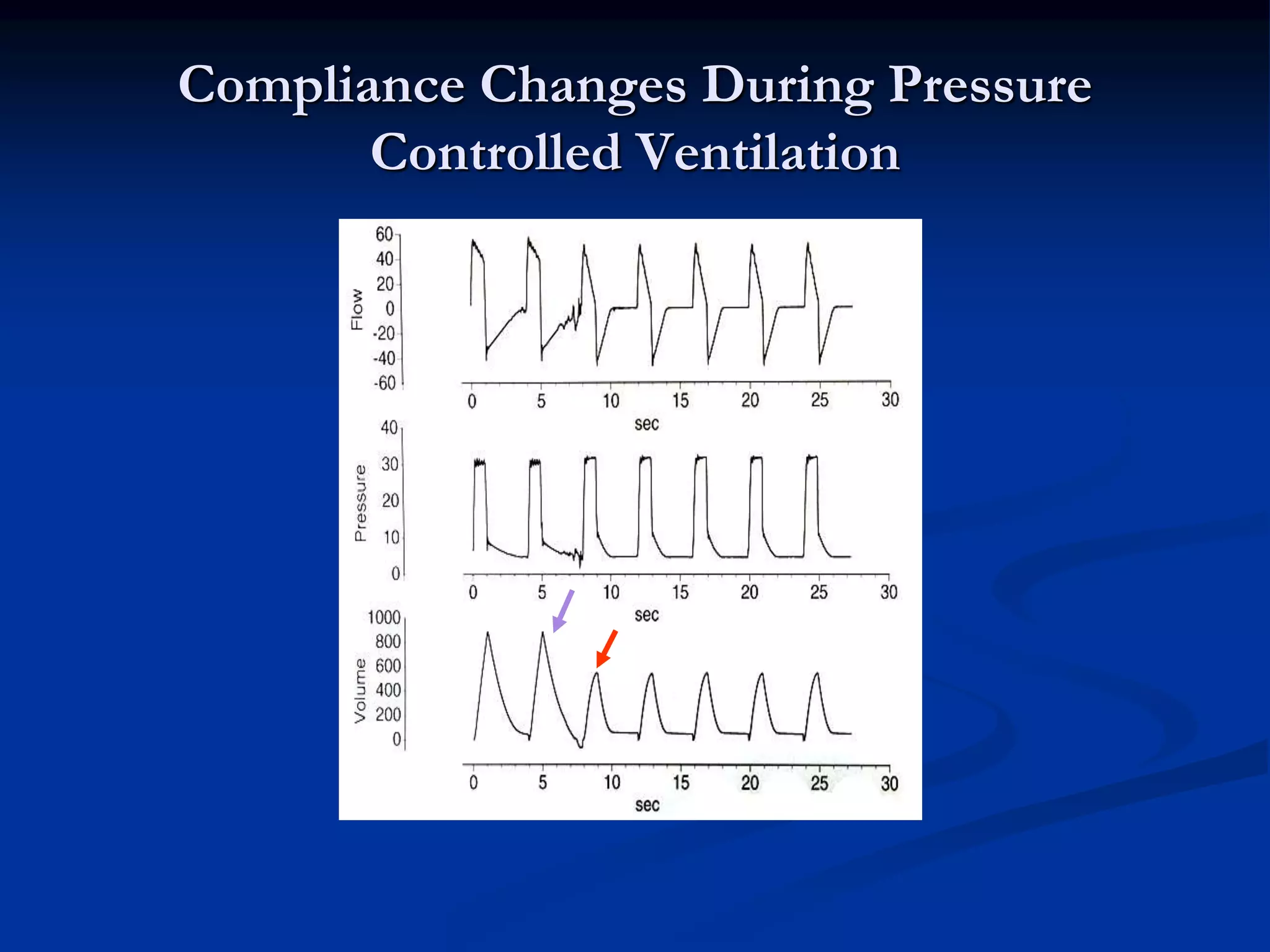 Compliance Changes During Pressure
Controlled Ventilation
 