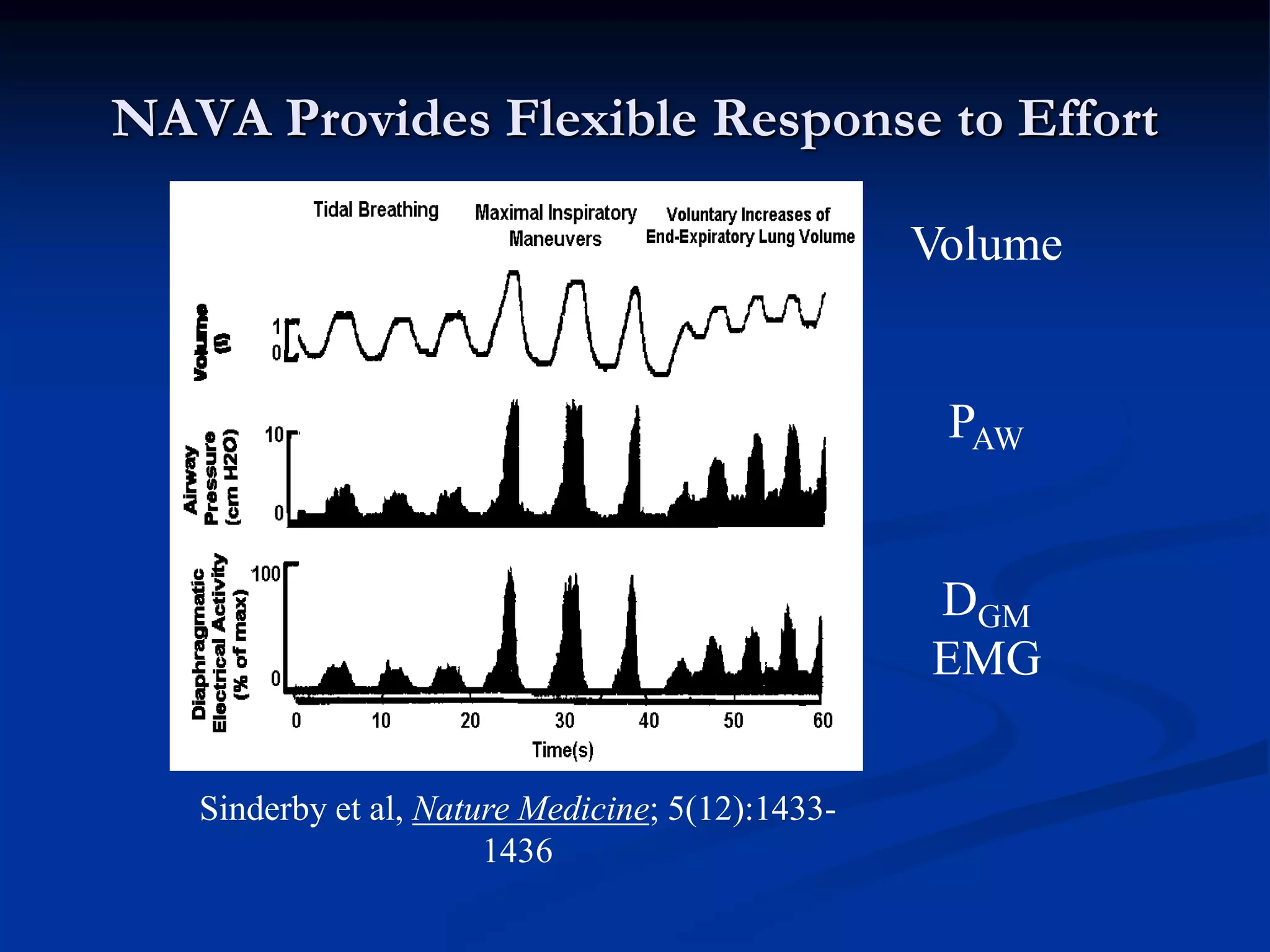 NAVA Provides Flexible Response to Effort
Volume
PAW
DGM
EMG
Sinderby et al, Nature Medicine; 5(12):1433-
1436
 