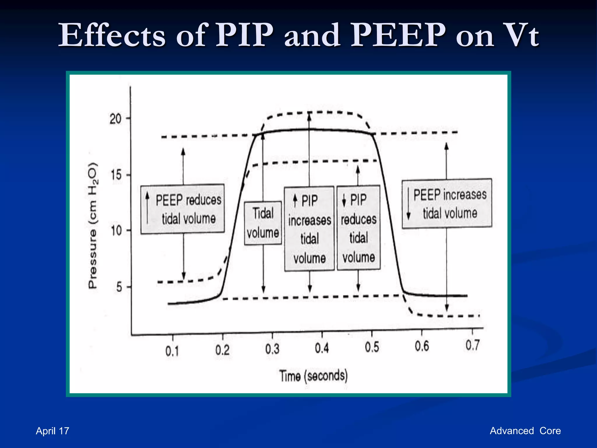 April 17 Advanced Core
Effects of PIP and PEEP on Vt
 