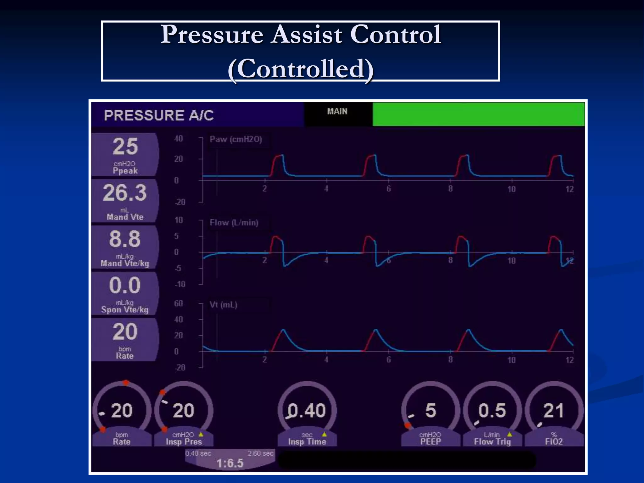 Pressure Assist Control
(Controlled)
 