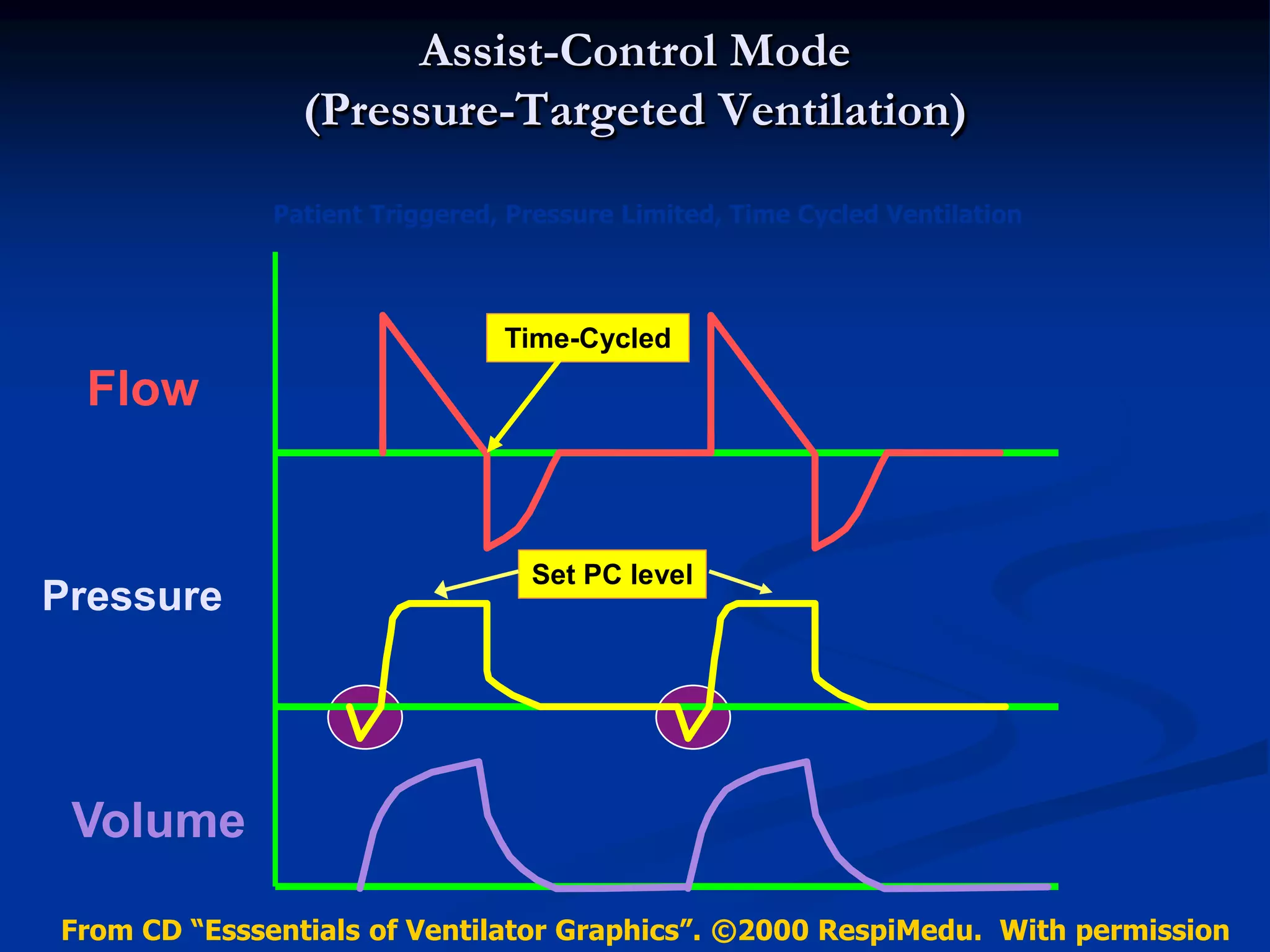 Assist-Control Mode
(Pressure-Targeted Ventilation)
Pressure
Flow
Volume
(L/min)
(cm H2O)
(ml)
Set PC level
Time (sec)
Time-Cycled
Patient Triggered, Pressure Limited, Time Cycled Ventilation
From CD “Esssentials of Ventilator Graphics”. ©2000 RespiMedu. With permission
 