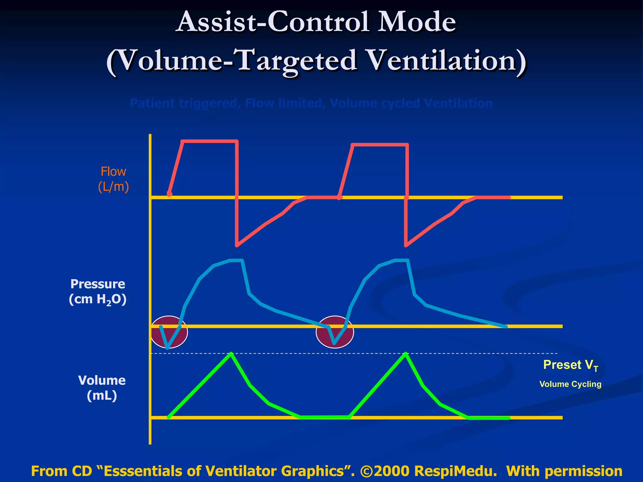 Assist-Control Mode
(Volume-Targeted Ventilation)
Time (sec)
Flow
(L/m)
Pressure
(cm H2O)
Volume
(mL)
Preset VT
Volume Cycling
Patient triggered, Flow limited, Volume cycled Ventilation
From CD “Esssentials of Ventilator Graphics”. ©2000 RespiMedu. With permission
 