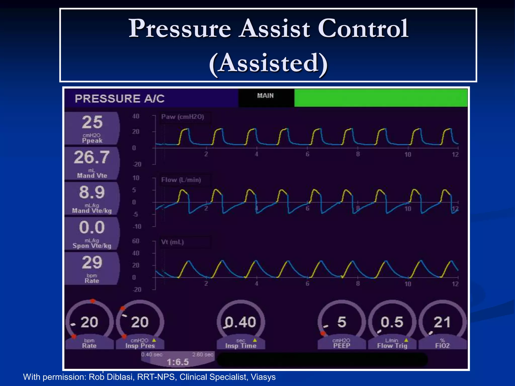 Pressure Assist Control
(Assisted)
Paw
Paw
Paw
With permission: Rob Diblasi, RRT-NPS, Clinical Specialist, Viasys
 