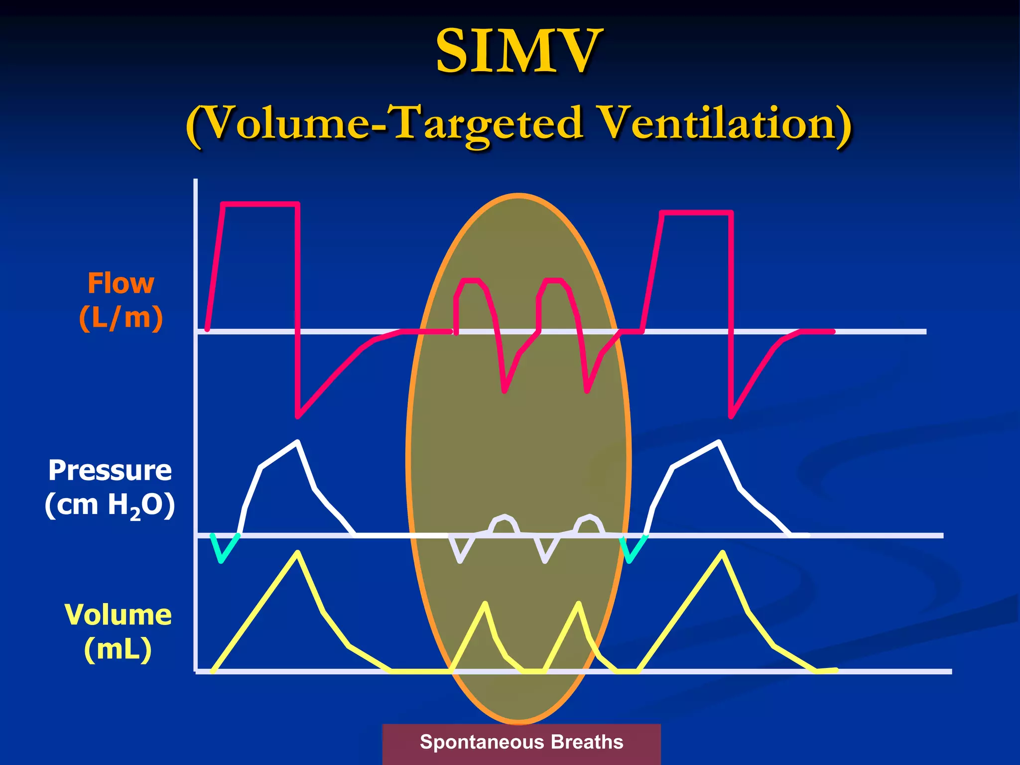 SIMV
(Volume-Targeted Ventilation)
Spontaneous Breaths
Flow
(L/m)
Pressure
(cm H2O)
Volume
(mL)
 