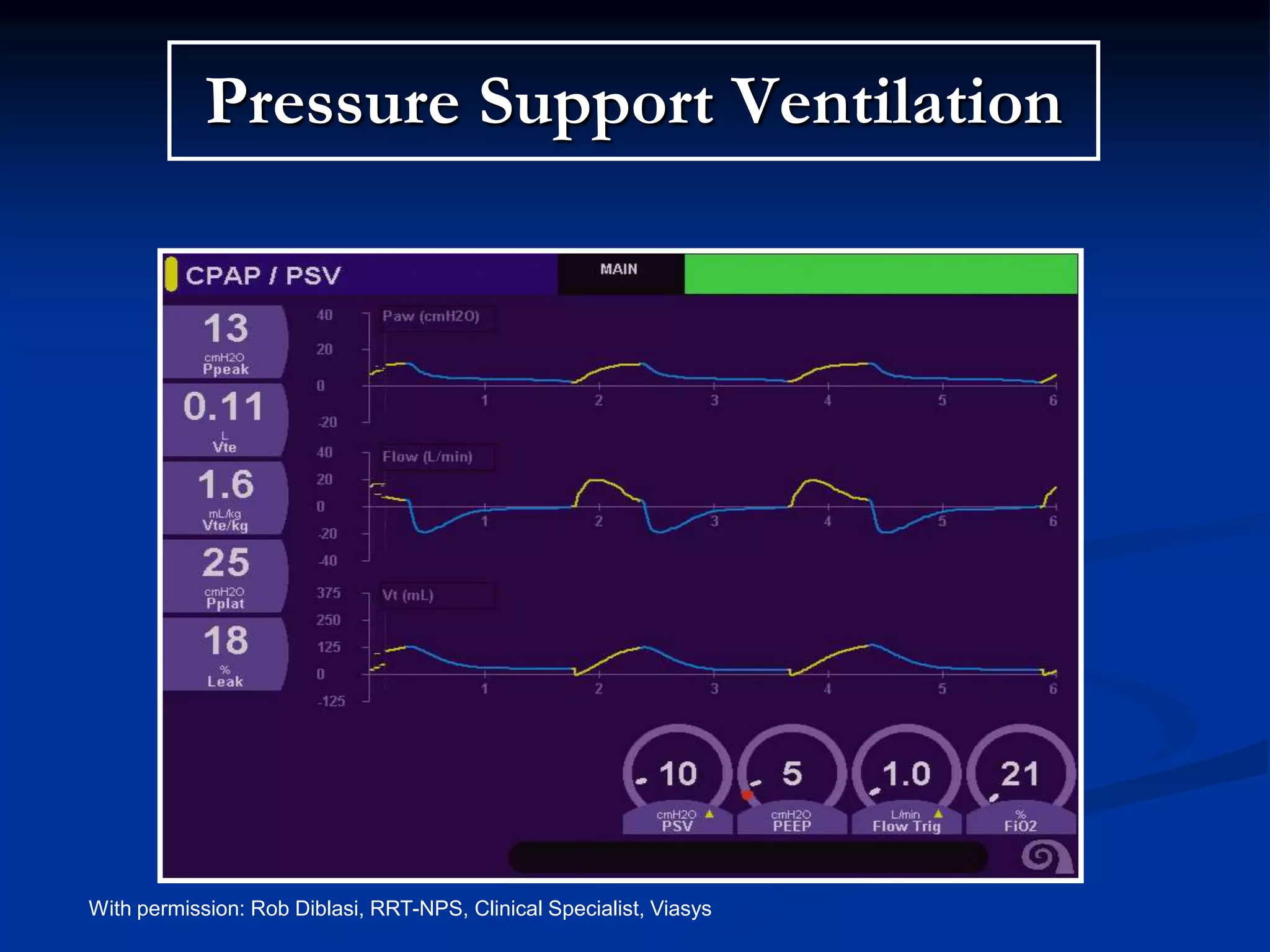 Pressure Support Ventilation
Paw CPAP
Paw PS
With permission: Rob Diblasi, RRT-NPS, Clinical Specialist, Viasys
 