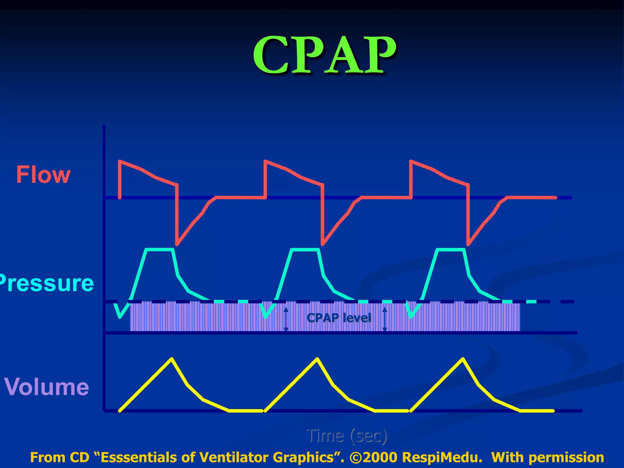 CPAP
Flow
Pressure
Volume
(L/min)
(cm H2O)
(ml)
CPAP level
Time (sec)
From CD “Esssentials of Ventilator Graphics”. ©2000 RespiMedu. With permission
 