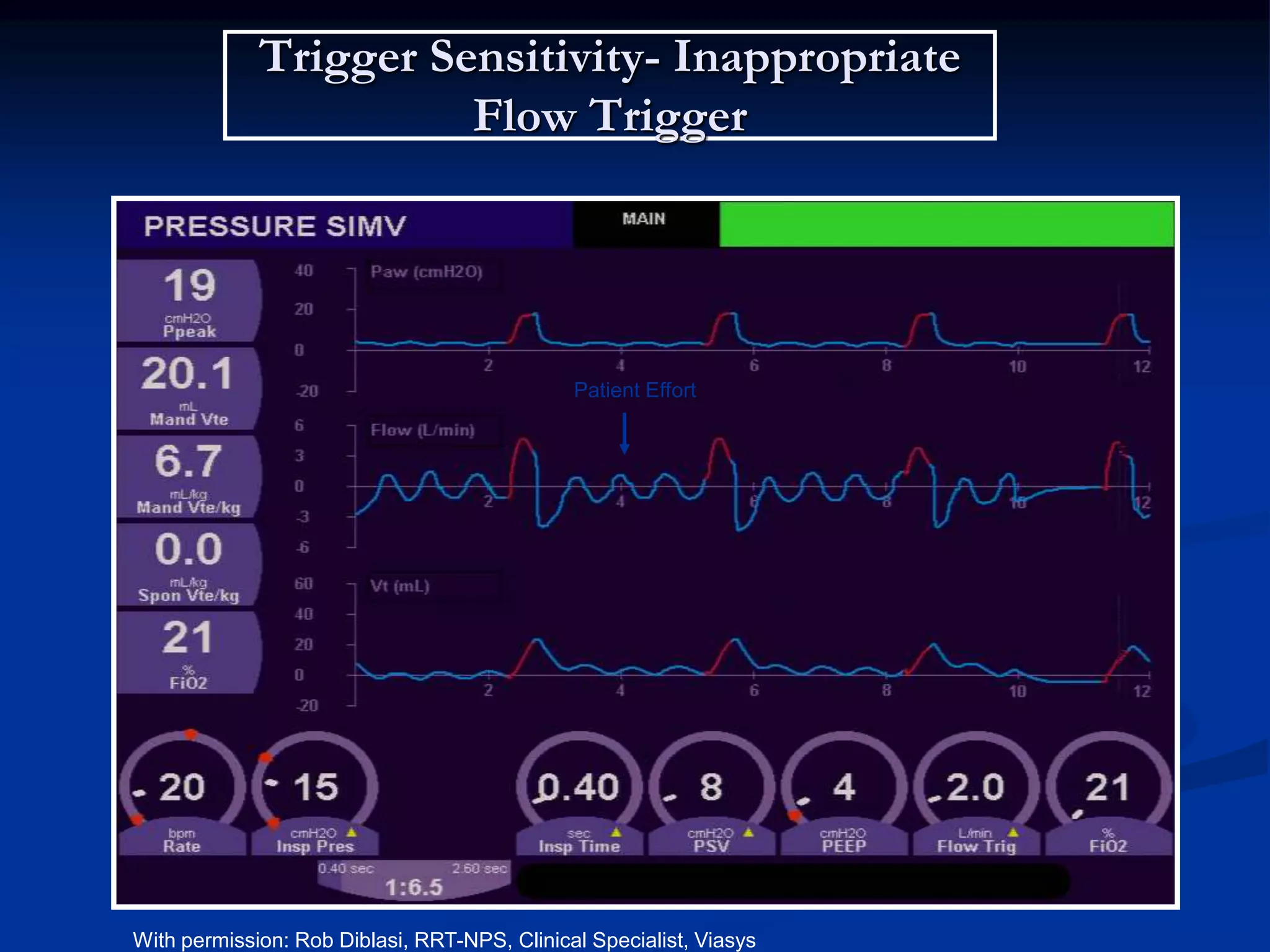 Trigger Sensitivity- Inappropriate
Flow Trigger
e
Sensitivity level
Time
Flow
Time
Patient Effort
With permission: Rob Diblasi, RRT-NPS, Clinical Specialist, Viasys
 