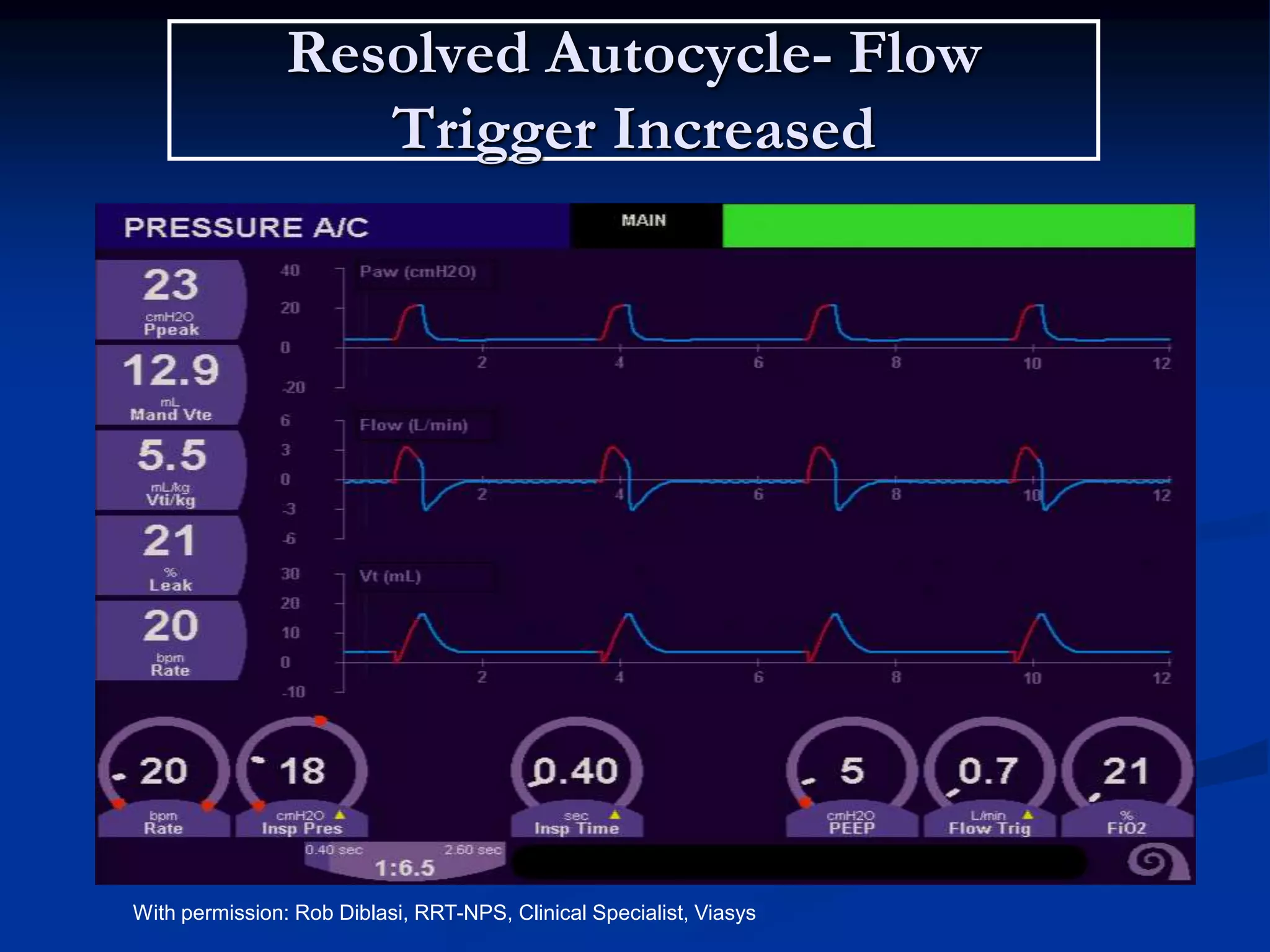Resolved Autocycle- Flow
Trigger Increased
With permission: Rob Diblasi, RRT-NPS, Clinical Specialist, Viasys
 
