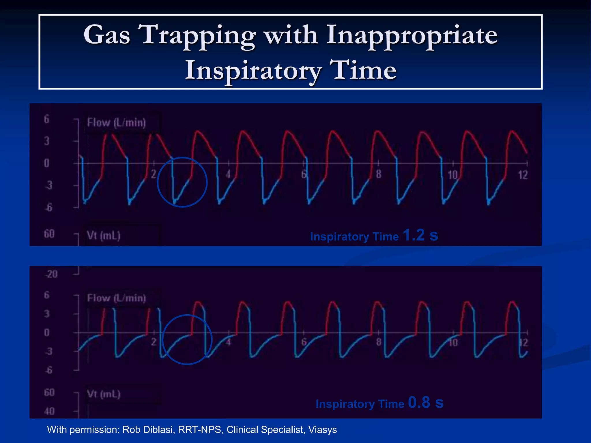 Gas Trapping with Inappropriate
Inspiratory Time
Inspiratory Time 1.2 s
Inspiratory Time 0.8 s
With permission: Rob Diblasi, RRT-NPS, Clinical Specialist, Viasys
 