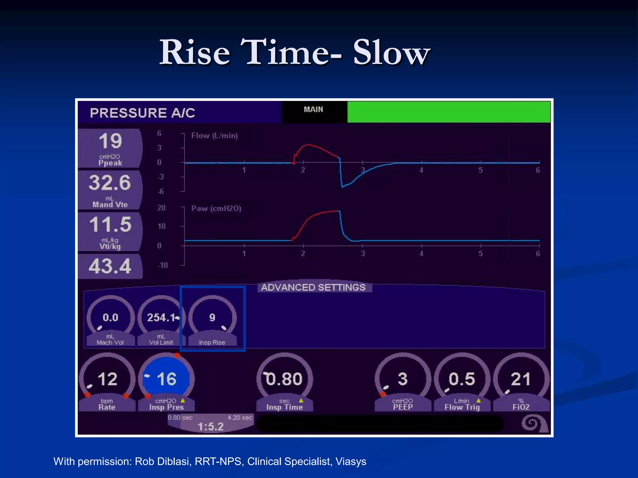Rise Time- Slow
With permission: Rob Diblasi, RRT-NPS, Clinical Specialist, Viasys
 