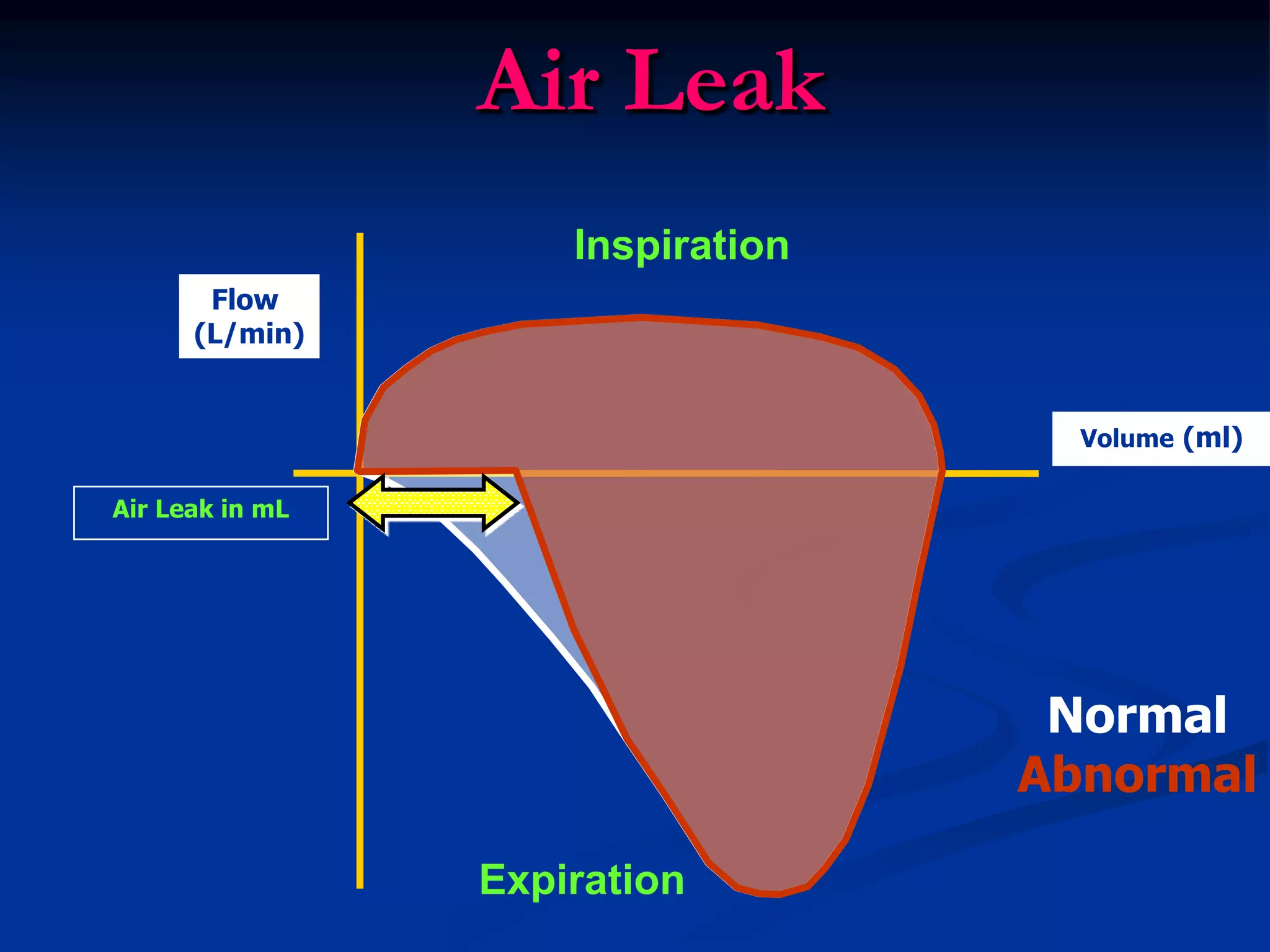 Air Leak
Inspiration
Expiration
Volume (ml)
Flow
(L/min)
Air Leak in mL
Normal
Abnormal
 