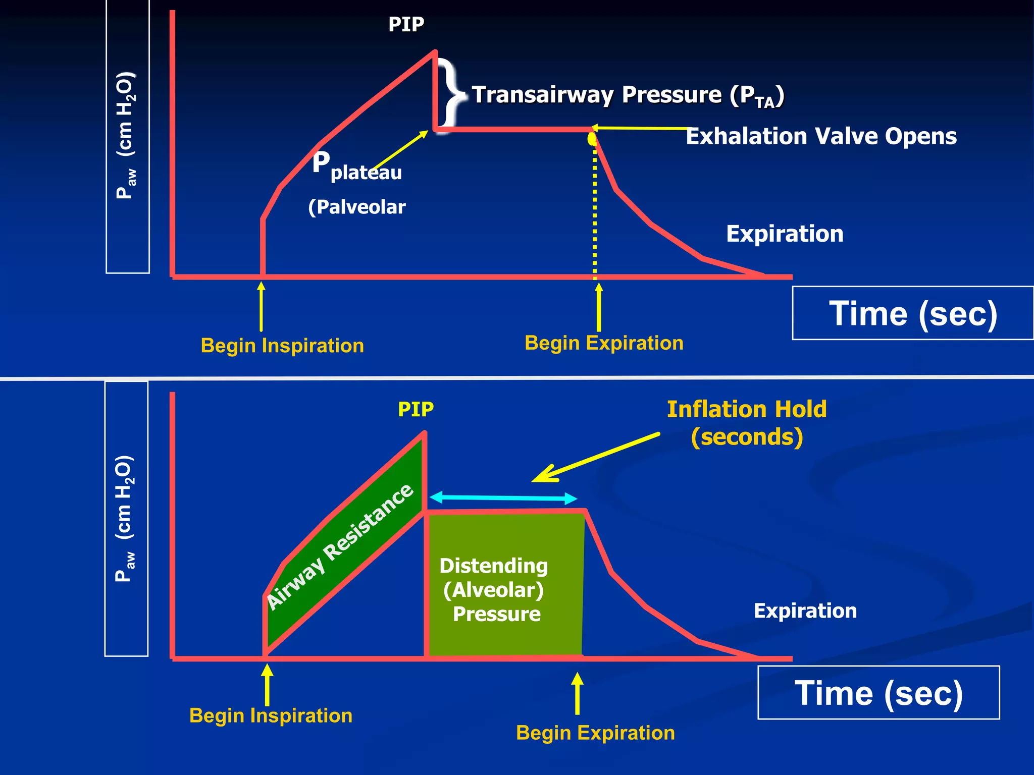 Begin Inspiration
Begin Expiration
Paw(cmH2O)
Time (sec)
Distending
(Alveolar)
Pressure Expiration
Inflation Hold
(seconds)
Begin Expiration
Paw(cmH2O)
Time (sec)
Begin Inspiration
PIP
Pplateau
(Palveolar
Transairway Pressure (PTA)
} Exhalation Valve Opens
Expiration
PIP
 
