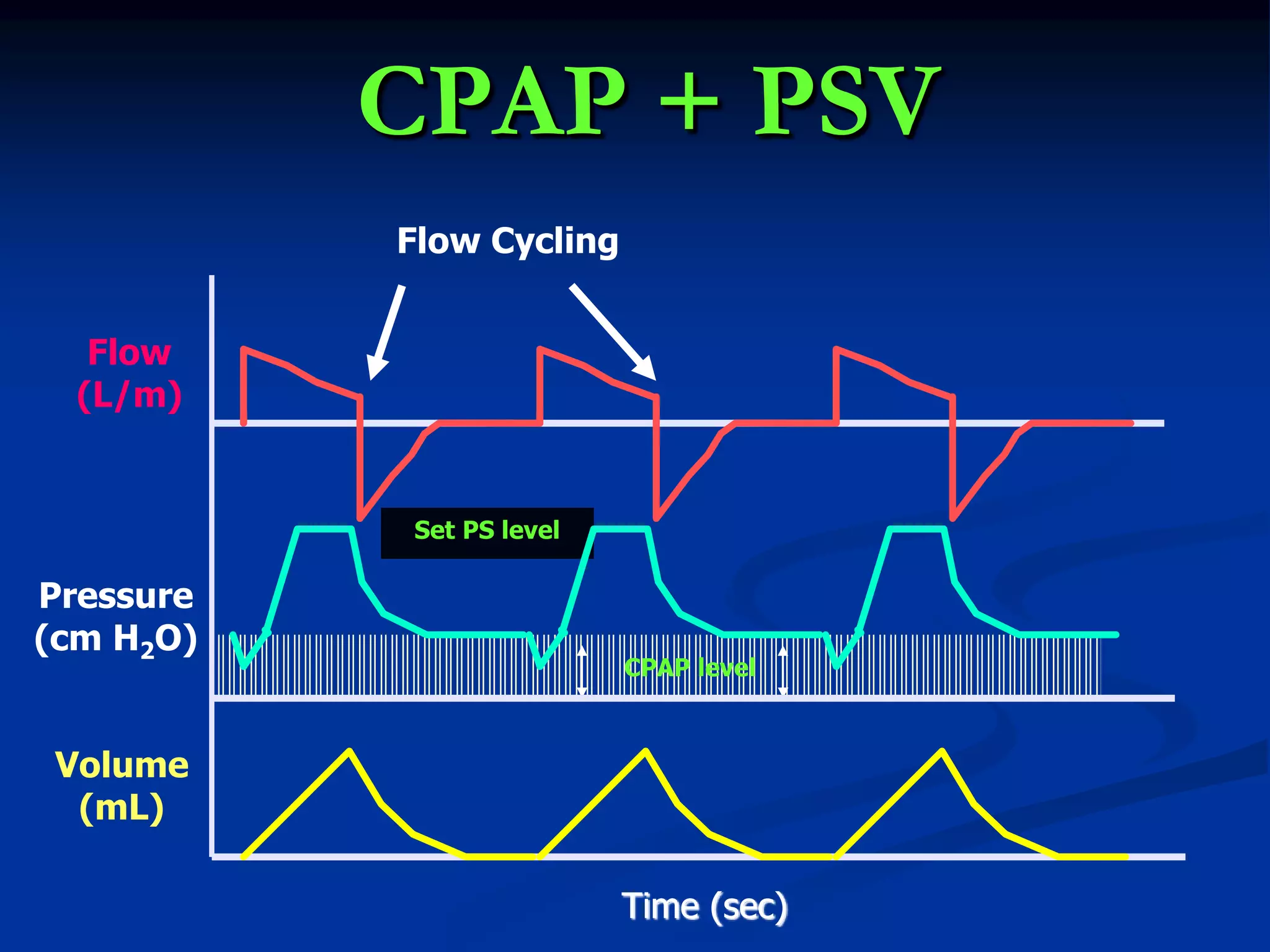CPAP + PSV
Set PS level
CPAP level
Time (sec)
Flow
(L/m)
Pressure
(cm H2O)
Volume
(mL)
Flow Cycling
 