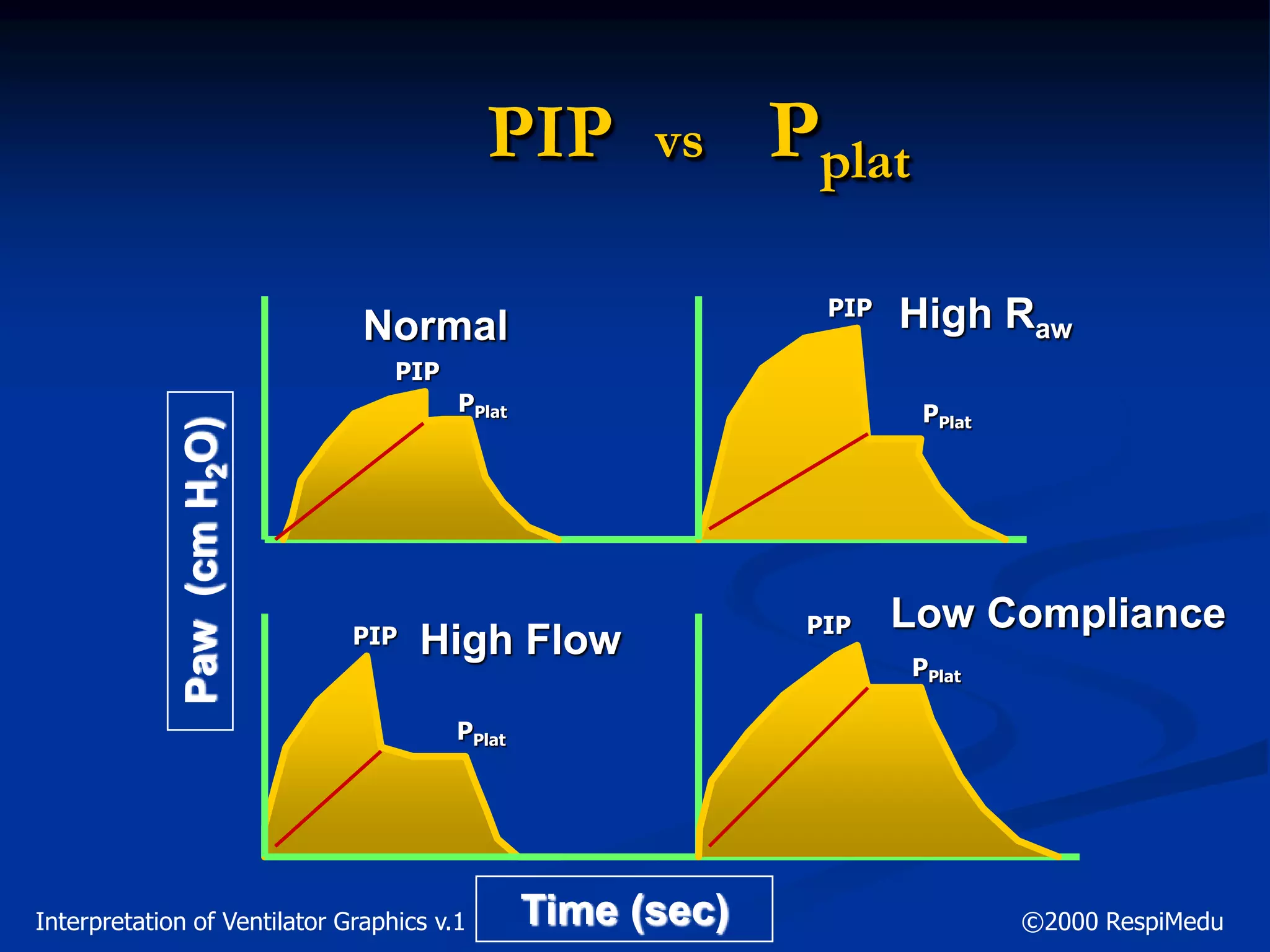 PIP vs Pplat
Normal High Raw
High Flow
Low Compliance
Time (sec)
Paw(cmH2O)
PIP
PPlat
PIP
PIP PIP
PPlat
PPlat
PPlat
Interpretation of Ventilator Graphics v.1 ©2000 RespiMedu
 