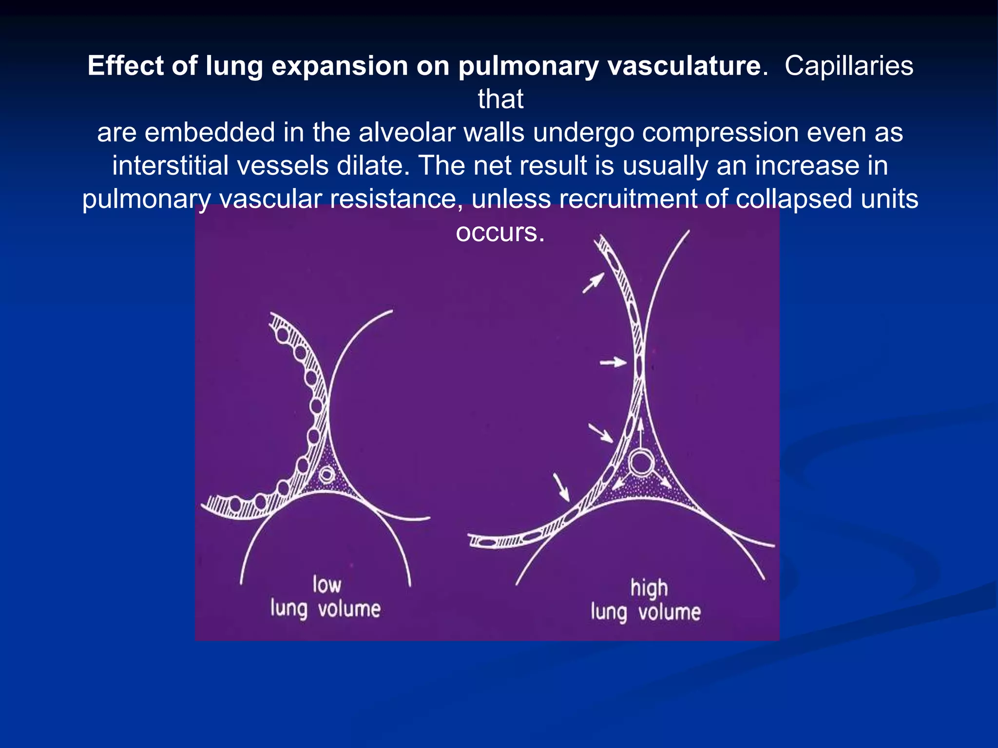 Effect of lung expansion on pulmonary vasculature. Capillaries
that
are embedded in the alveolar walls undergo compression even as
interstitial vessels dilate. The net result is usually an increase in
pulmonary vascular resistance, unless recruitment of collapsed units
occurs.
 