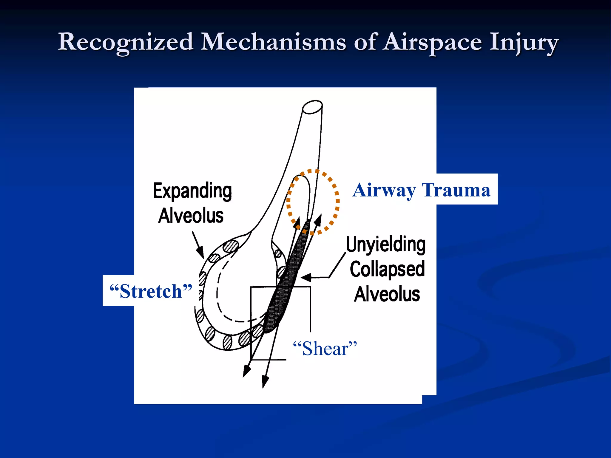 Recognized Mechanisms of Airspace Injury
“Stretch”
“Shear”
Airway Trauma
 
