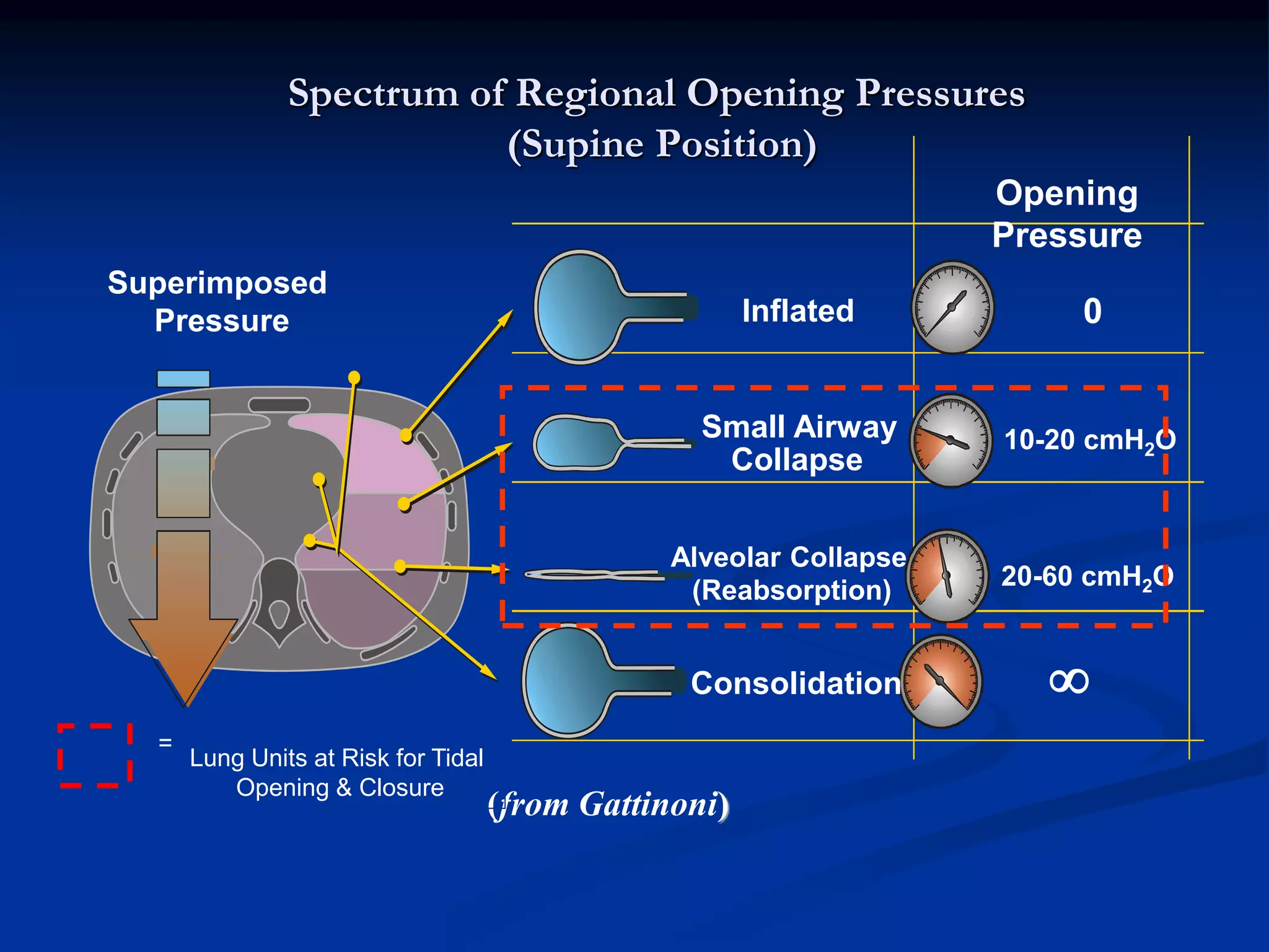 Spectrum of Regional Opening Pressures
(Supine Position)
Superimposed
Pressure Inflated 0
Alveolar Collapse
(Reabsorption) 20-60 cmH2O
Small Airway
Collapse
10-20 cmH2O
Consolidation 
(from Gattinoni)
Lung Units at Risk for Tidal
Opening & Closure
=
Opening
Pressure
 