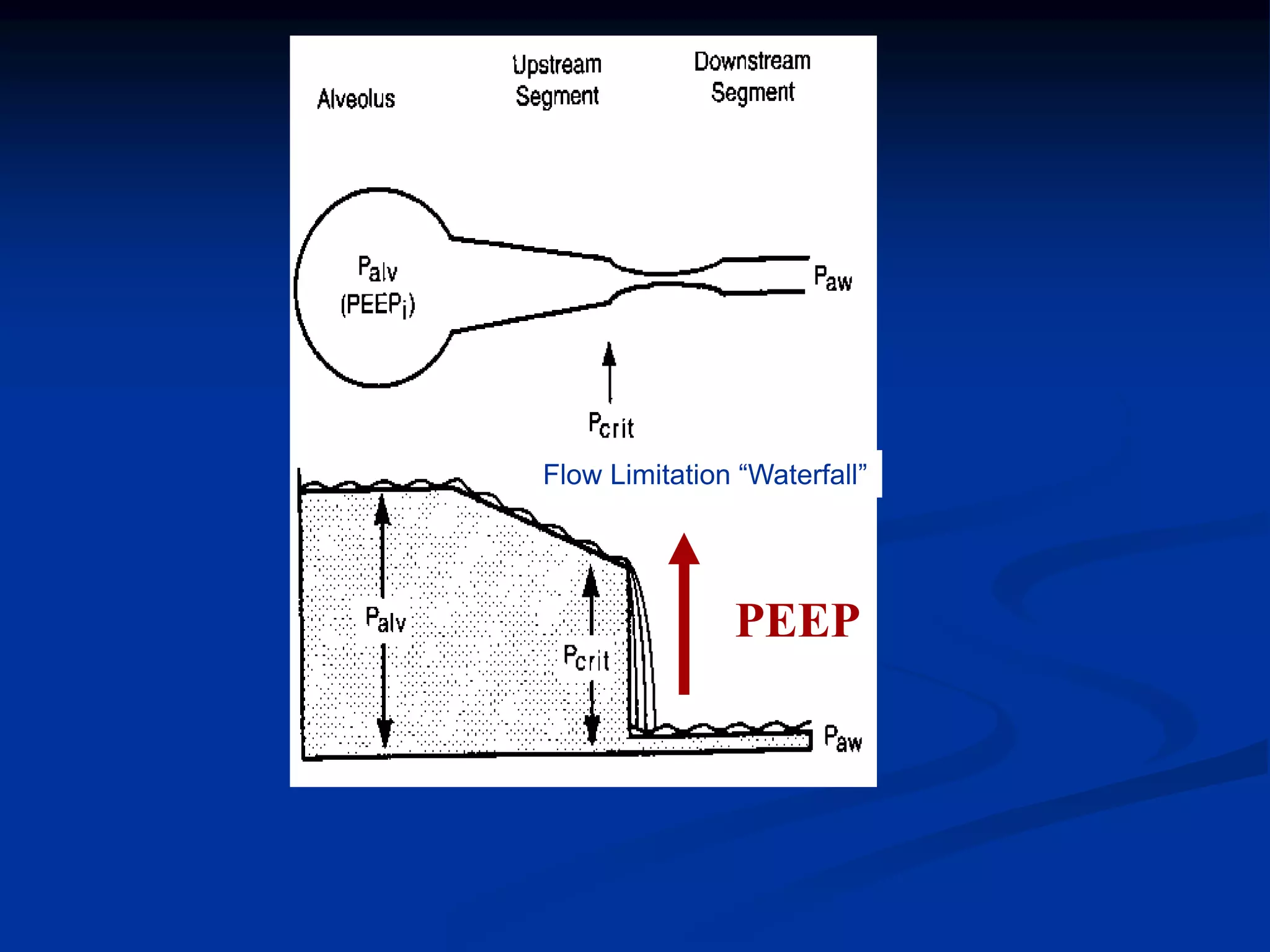 PEEP
Flow Limitation “Waterfall”
 