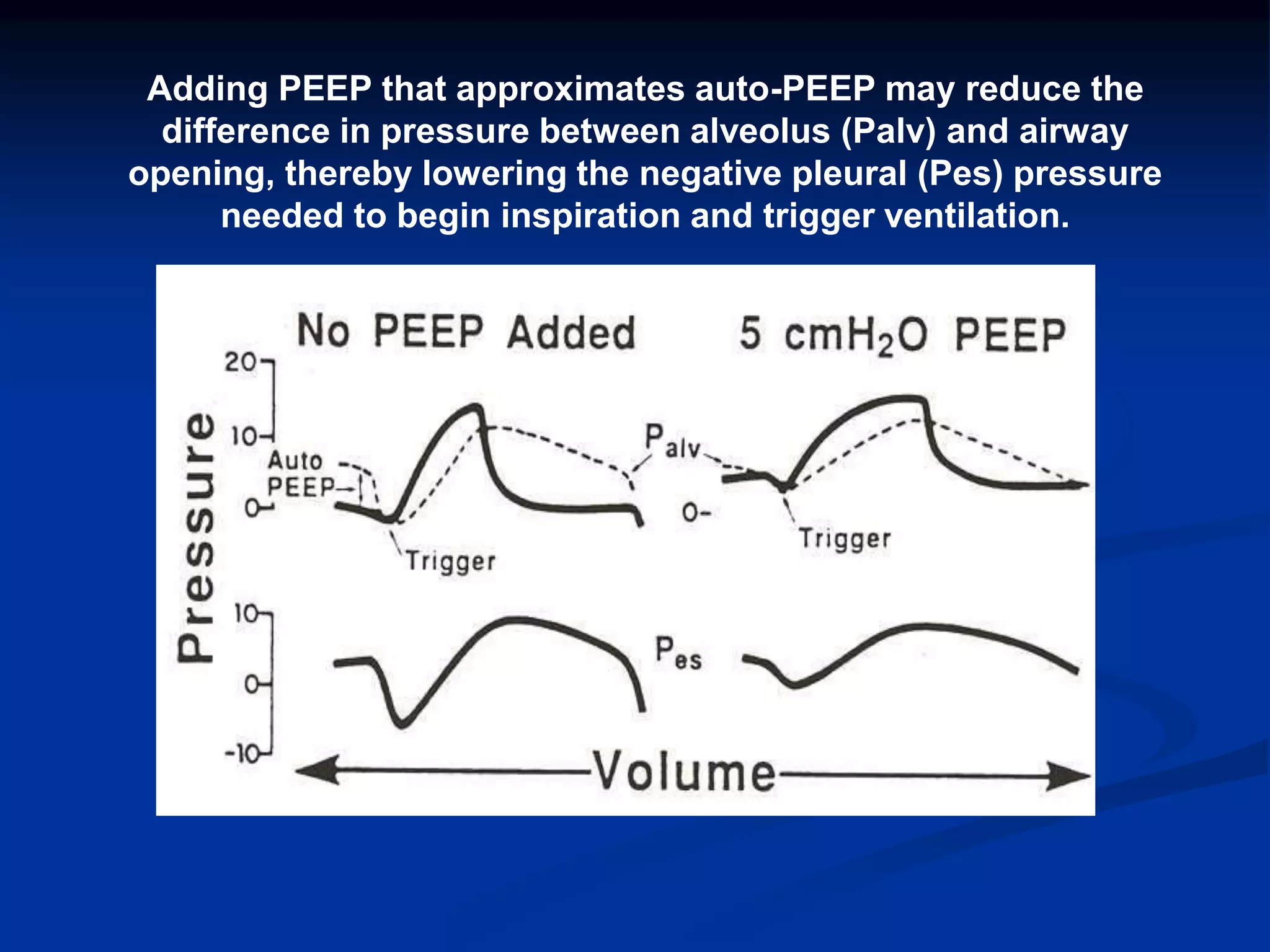 Adding PEEP that approximates auto-PEEP may reduce the
difference in pressure between alveolus (Palv) and airway
opening, thereby lowering the negative pleural (Pes) pressure
needed to begin inspiration and trigger ventilation.
 