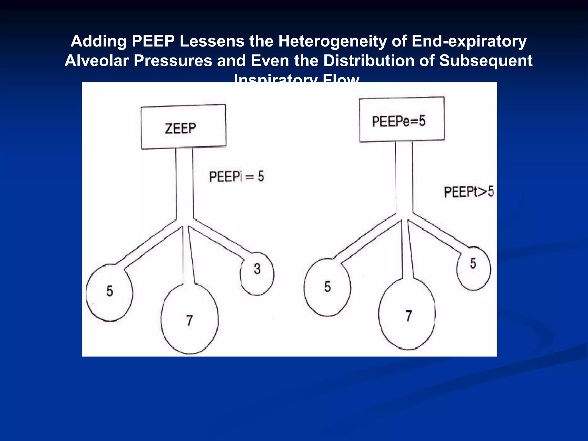 Adding PEEP Lessens the Heterogeneity of End-expiratory
Alveolar Pressures and Even the Distribution of Subsequent
Inspiratory Flow.
 