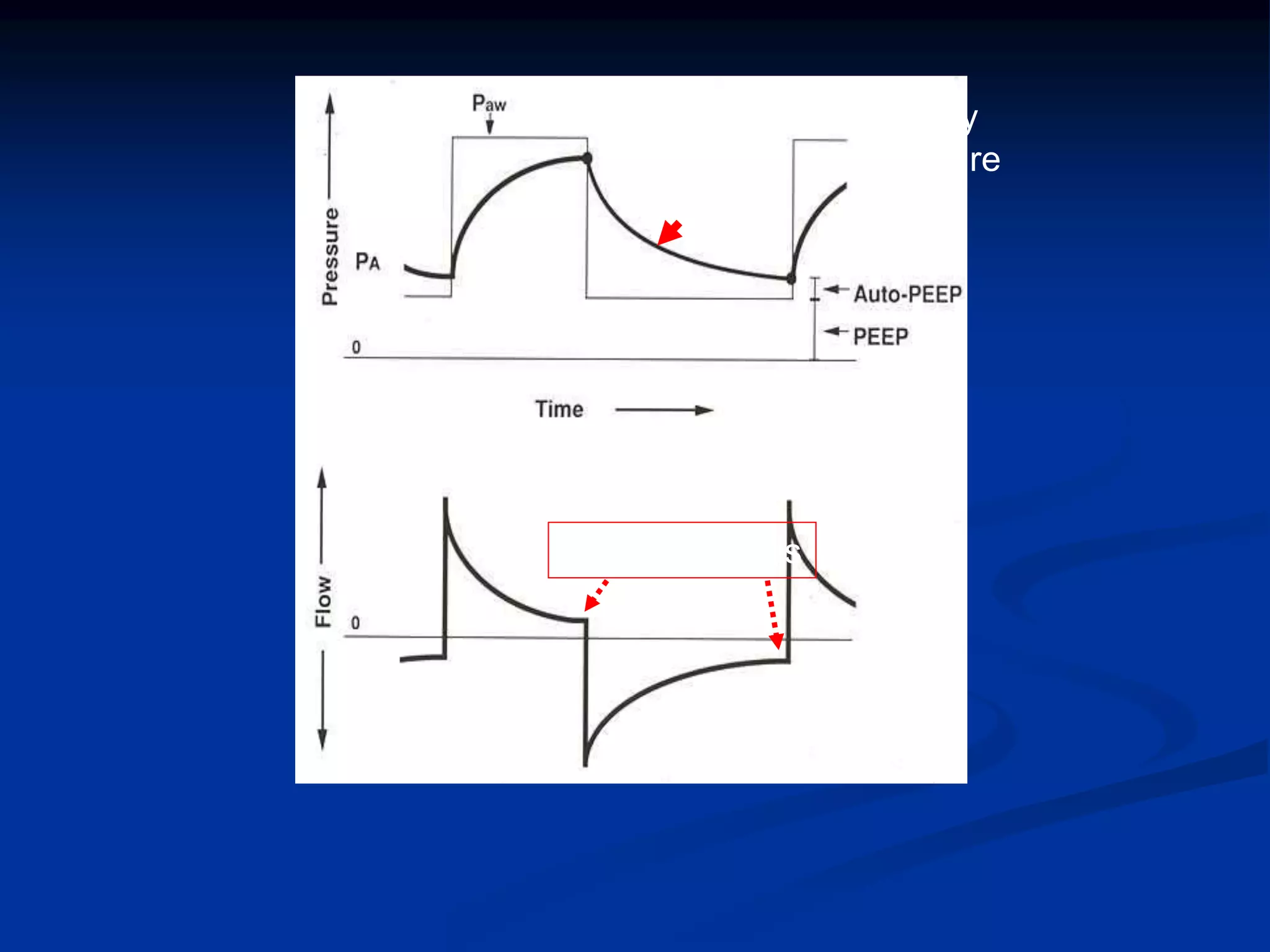 Alveolar
Pressure
Airway
Pressure
Residual Flows
 